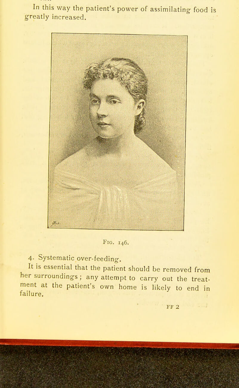 In this way the patient's power of assimilating- food is greatly increased. Fig. 146. 4. Systematic over-feeding. It is essential that the patient should be removed from her surroundings ; any attempt to carry out the treat- ment at the patient's own home is likely to end in failure. FF 2