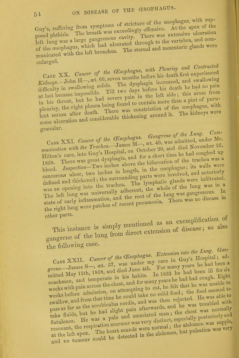 , . nf stricture of the oesophagus, with sup- Guy's, suffering from ^P^^^ffensive. At the apex of the posed phthisis. Thebrea^ ex^n 7 u 0Q left lung was a large S™f*™™™J throu„h to the vertebra, and com- enlarged. CASE XX. Cancer of the ^^S^e^ difficulty in swallowmg sohds- The dysp ^ ^ ^ n at last became impossible Till tw> y side. ^ arose from t his throat, but he had seveie^Pa- inJ more than a pint of para- pleurisy, the right pleura bemg. found to cont^ ^ ^ ^ t^^^1** ar0Undit'  granular. _ -, r,,„P-rene of the Lung. Com- CASBXXI. On^** mu,„c«iicn with the r^ftC-J^ on October 20, and died November 25 Hilton's care, into Gu/s Hospital, on Oct ^ ^ ^ d up f858. There was great ^E^^rf ^ tracbea was a Wood. In^o.-Two inches abov he ft u rancerous ulcer, two inches in le°?\ were involved, and anteriorly defined and thickened; the surrounding Prt* we ^ infiUrated. tas an opening into the Meoi the lung was in^ The left lung was universally adherent ^ ou8. In S. of ~* There was no disease m tbe right lung were patches of rece P other parts. ^ gangrene ot tne iuug ^ the following case. Vrtensioninto the Lung, (ran- n XXII Cancer o/ Oe (Esophagus. Extensw _ ^ CASE5ames's-%t. 57, was under my £eJ ^ he had been a ^^ri'th 1858, and died June 4th For many y ffl ^ swallow,andfromthat tdi ndwas then ^^^U with pass as far as the ^°*^ afterwards, and he was ^le Lke fluids, but he had sihtp fl ^ . fte chest was ^ and no tumour could oe u