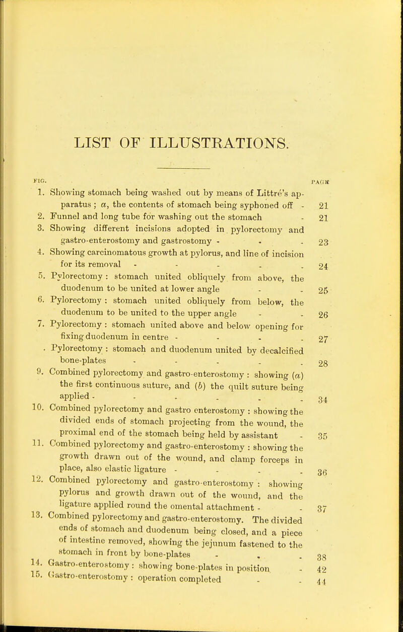 LIST OF ILLUSTRATIONS. ™, PAGK 1. Showing stomach being washed out by means of Littre's ap- paratus ; a, the contents of stomach being syphoned off - 21 2. Funnel and long tube for washing out the stomach - 21 3. Showing different incisions adopted in pylorectomy and gastroenterostomy and gastrostomy - - - 23 4. Showing carcinomatous growth at pylorus, and line of incision for its removal - - - . - 24 5. Pylorectomy : stomach united obliquely from above, the duodenum to be united at lower angle - . 25 6. Pylorectomy : stomach united obliquely from below, the duodenum to be united to the upper angle - . 26 7. Pylorectomy : stomach united above and below opening for fixing duodenum in centre - - . - 27 . Pylorectomy : stomach and duodenum united by decalcified bone-plates - - . . - 28 9. Combined pylorectomy and gastro enterostomy : showing (a) the first continuous suture, and (b) the quilt suture being applied. - . . . - 34 10. Combined pylorectomy and gastro enterostomy : showing the divided ends of stomach projecting from the wound, the proximal end of the stomach being held by assistant - 35 11. Combined pylorectomy and gastro-enterostomy : showing the growth drawn out of the wound, and clamp forceps in place, also elastic ligature - - . - 36 12. Combined pylorectomy and gastro-enterostomy : showing pylorus and growth drawn out of the wound, and the ligature applied round the omental attachment - - 37 13. Combined pylorectomy and gastro-enterostomy. The divided ends of stomach and duodenum being closed, and a piece of intestine removed, showing the jejunum fastened to the stomach in front by bone-plates - . - 38 14. Gastro-enterostomy : showing bone-plates in position - 42 15. Gastroenterostomy: operation completed . . 44