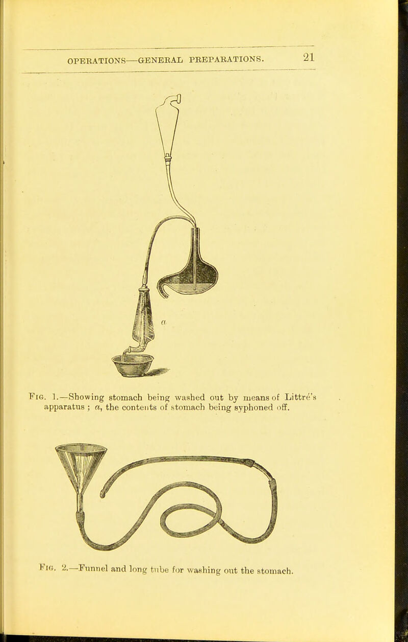 a. 2.—Funnel and long tube for washing out the stomach.