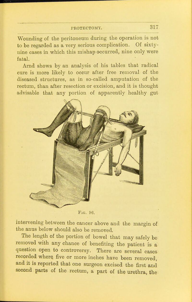 Wounding of the peritoneum during the operation is not to be regarded as a very serious complication. Of sixty- nine cases in which this mishap occurred, nine only were fatal. Arnd shows by an analysis of his tables that radical cure is more likely to occur after free removal of the diseased structures, as in so-called amputation of the rectum, than after resection or excision, and it is thought advisable that any portion of apparently healthy gut Fig. 96. intervening between the cancer above and the margin of the anus below should also be removed. The length of the portion of bowel that may safely be removed with any chance of benefiting the patient is a question open to controversy. There are several cases recorded where, five or more inches have been removed, and it is reported that one surgeon excised the first and second parts of the rectum, a part of the urethra, the