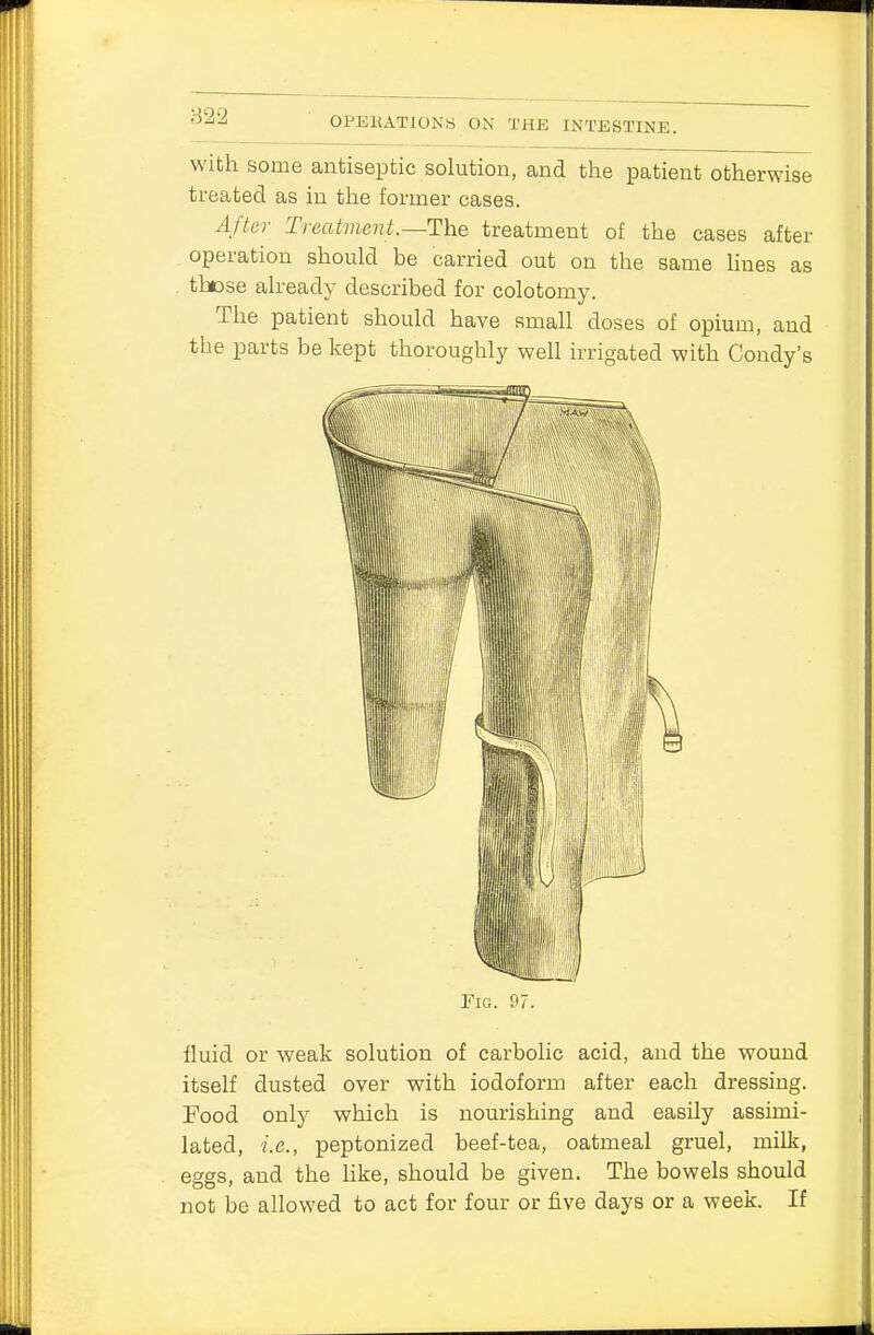 with some antiseptic solution, and the patient otherwise treated as in the former cases. After Treatment.—The treatment of the cases after operation should be carried out on the same lines as those already described for colotomy. The patient should have small doses of opium, and the parts be kept thoroughly well irrigated with Condy's Fig. 97. fluid or weak solution of carbolic acid, and the wound itself dusted over with iodoform after each dressing. Food only which is nourishing and easily assimi- lated, i.e., peptonized beef-tea, oatmeal gruel, milk, eggs, and the like, should be given. The bowels should not be allowed to act for four or five days or a week. If