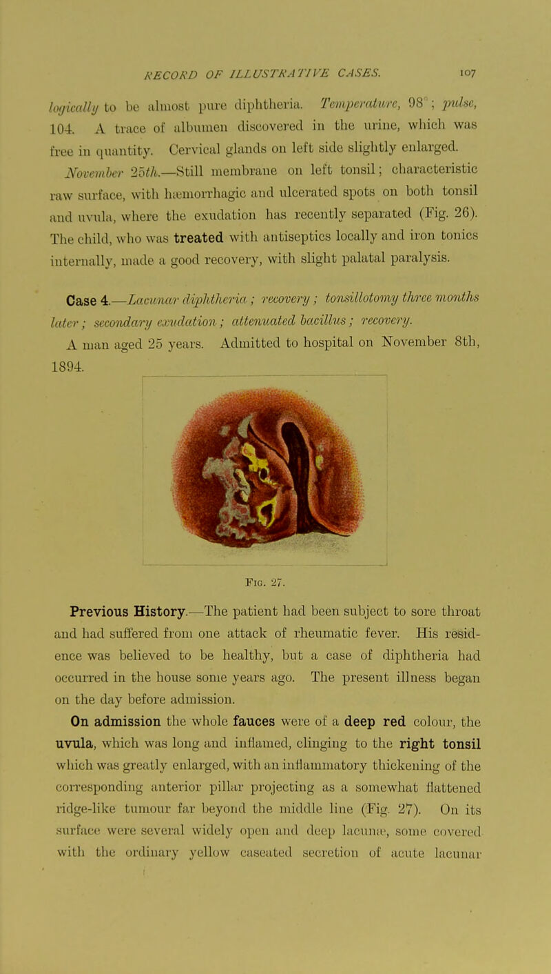 logically to be almost pure diphtheria. Temperature, 98 ; pulse, 104. A trace of albumen discovered in the urine, which was free in quantity. Cervical glands on left side slightly enlarged. November loth.—Still membrane on left tonsil; characteristic raw surface, with lnemorrhagic and ulcerated spots on both tonsil and uvula, where the exudation has recently separated (Fig. 26). The child, who was treated with antiseptics locally and iron tonics internally, made a good recovery, with slight palatal paralysis. Case 4.—Lacunar diphtheria; recovery; tonsillotomy three months later; secondary exudation; attenuated bacillus; recovery. A man aged 25 years. Admitted to hospital on November 8th, 1894. Fig. 27. Previous History.—The patient had been subject to sore throat and had suffered from one attack of rheumatic fever. His resid- ence was believed to be healthy, but a case of diphtheria had occurred in the house some years ago. The present illness began on the day before admission. On admission the whole fauces were of a deep red colour, the uvula, which was long and inflamed, clinging to the right tonsil which was greatly enlarged, with an inflammatory thickening of the corresponding anterior pillar projecting as a somewhat flattened ridge-like bumour far beyond the middle line (:Fig. 21). On its surface were several widely open and deep lacunae, some covered with the ordinary yellow caseated secretion of acute lacunar