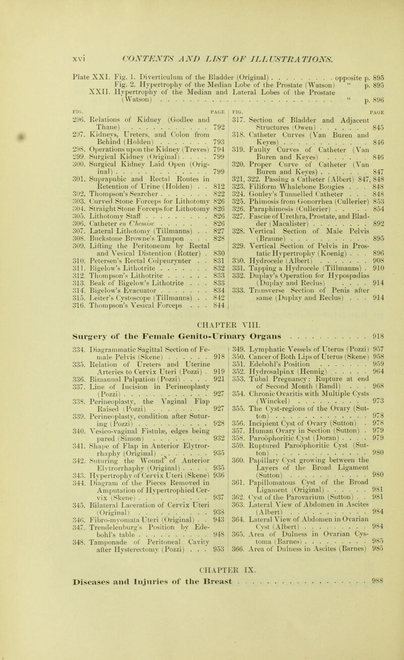 Plate XXI. Fig. 1. Diverticulum of the Bladder (Original) opposite p. 895 Fig. 2. Hypertrophy of the Median Lobe of the Prostate (Watson)  p. 895 XXII. Hypertrophy of the Median and Lateral Lobes of the Prostate (Watson) , .  p. 896 FIG. PAGE J FIG. 290. Relations of Kidney (Godlee and j 317. Thane) 792 2'J7. Kidneys, Ureters, and Colon from 318. Behind (Holden) 793 298. Operations upon the Kidney (Treves) 794 319. 299. Surgical Kidnev (Original) .... 799 300. Surgical Kidnev Laid Open (Orig- 320. inal) . . . .' .799 301. Suprapubic and Rectal Routes in 321, Retention of Urine (Holden) . . 812 ! 323. 302. Thompson's Searcher 822 324. 303. Curved Stone Forceps for Lithotomy 826 325. 1504. Straight Stone Forceps for Lithotomy 826 ! 326. 305. Lithotomy Staff . 826 327. 306. Catheter en Chemise 826 307. Lateral Lithotomy (Tillmanns) . . 827 328. 308. Buckstone Browne's Tampon . . . 828 309. Lifting the Peritoneum by Rectal 329. and Vesical Distention (Rotter) . 830 310. Petersen's Rectal Colpeurynter . . 8311330. 311. Bigelow's Lithotrite ..*..... 832 j 331. 312. Thompson's Lithotrite 833 332. 313. Beak of Bigelow's Lithotrite ... 833 314'. Bigelow's Evacuator 834 ; 333. 315. Leiter's Cystoscope (Tillmanns) . . 842 316. Thompson's Vesical Forceps . . . 844 | Section of Bladder and Adjacent Structures (Owen) 845 Catheter Curves (Van Buren and Keyes) 846 Faulty Curves of Catheter (Van Buren and Keyes) 846 Proper Curve of Catheter (Van Buren and Keves) 847 322. Passing a Catheter (Albert) 847, 848 Filiform Whalebone Bougies . . . 848 Gouley's Tunnelled Catheter . . . 848 Phimosis from Gonorrhea (Cullerier) 853 Paraphimosis (Cullerier) . . . . 854 Fasciae of Urethra, Prostate, and Blad- der (Macalister) 892 Vertical Section of Male Pelvis (Braune) 895 Vertical Section of Pelvis in Pros- tatic Hvpertrophv (Koenig) . . . 896 Hydrocele (Albert) 908 Tapping a Hydrocele (Tillmanns) . 910 Duplay's Operation for Hypospadias (Du'play and Reclus) 914 Transverse Section of Penis after same (Dnplav and Reclus) . . . 914 CHAPTER VIII. Surgery of the Female Genito-Urinary Organs 918 334. Diagrammatic Sagittal Section of Fe- 349. male Pelvis (Skene) 918 350. 335. Relation of Ureters and Uterine 351. Arteries to Cervix Uteri (Pozzi) . 919 352. 336. Bimanual Palpation (Pozzi) . ... 921 353. 337. Line of Incision in Perineoplastv (Pozzi) '927 354. 338. Perineoplastv, the Vaginal Flap Raised (Pozzi) 927 355. 339. Perineoplastv, condition after Sutur- ing (Pozzi) .928 356. 340. Vesico-vaginal Fistula?, edges being 357. pared (Simon) 932 358. 341. Shape of Flap in Anterior Elvtror- 359. rhaphy (Original) •>. . . . . , 935 342. Suturing the Wound' of Anterior 360. Elvtrorrhaphy (Original) .... 935 343. Hypertrophy of Cervix Uteri (Skene) 936 344. Diagram of the Pieces Removed in 361. Amputation of Hypertrophied Cer- vix (Skene) 937 362. 345. Bilateral Laceration of Cervix Uteri 363. (Original) 938 340. Fibro-myomata Uteri (Original) . . 943,364. 347. Trendelenburg's Position bv Ede- bohl's table * ... 948 365. 348. Tamponade of Peritoneal Cavity- after Hysterectomy (Pozzi) . . . 953 366. Lymphatic Vessels of Uterus (Pozzi) Cancer of Both Lips of Uterus (Skene) Edebohl's Position Hydrosalpinx (Hennig^ Tubal Pregnancy: Rupture at end of Second Month (Band 1) . . . Chronic Ovaritis with Multiple Cysts (Winckel) . The Cyst-regions of the Ovary (Sut- ton) Incipient Cyst of Ovary (Sutton) . Human Ovary in Section (Sutton) . Paroophoritic Cyst (Doran) . . . . Ruptured Paroophoritic Cyst (Sut- ton) Papillary Cyst growing between the Layers of the Broad Ligament (Sutton) Papillomatous Cyst of the Broad Ligament (Original) Cyst of the Parovarium (Sutton) . . Lateral View of Abdomen in Ascites (Albert) Lateral Mew of Abdomen in Ovarian Cyst (Albert) ......... Area of Dulness in Ovarian Cys- toma (Barnes) Area of Dulness in Ascites (Barnes) 957 958 959 964 968 973 978 978 979 979 980 980 981 981 984 984 985 985 CHAPTER IX. Diseases and Injuries of the Breast . 9ss