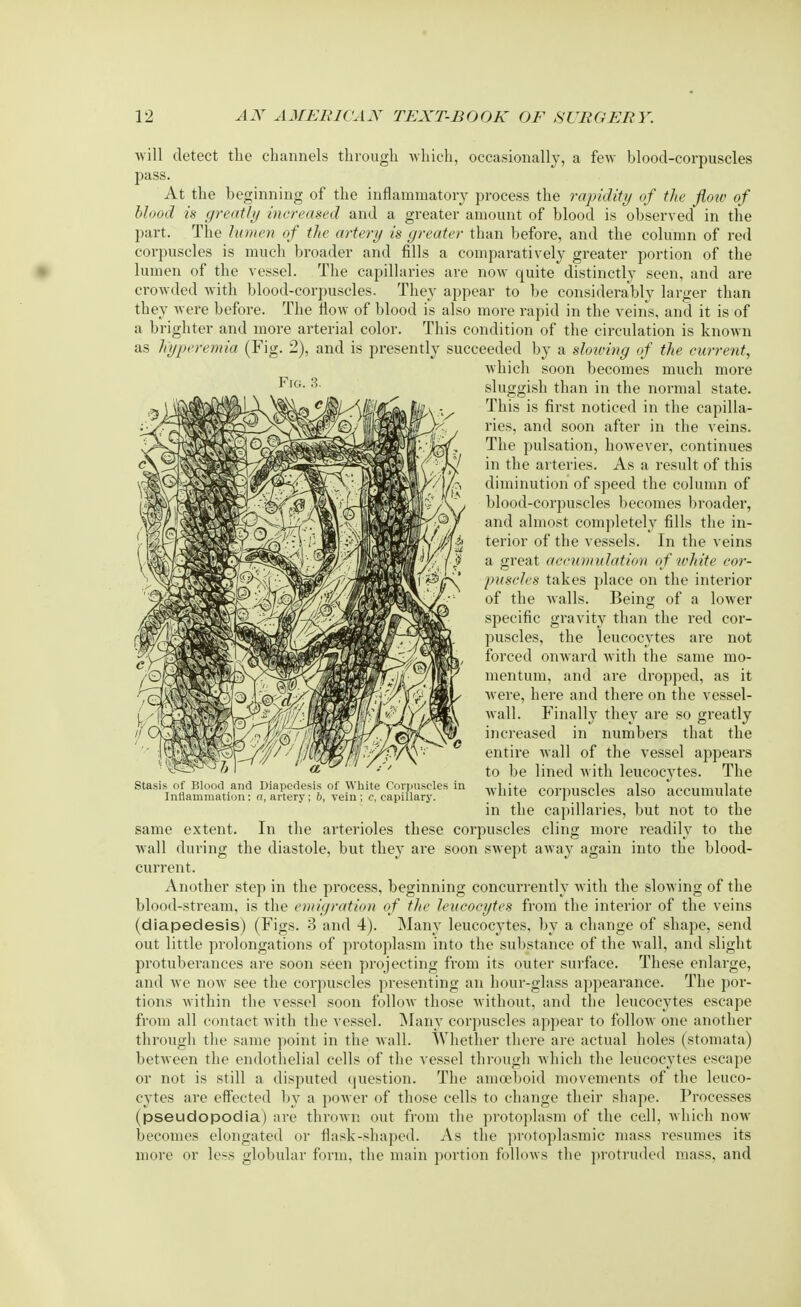 will detect the channels through which, occasionally, a few blood-corpuscles pass. At the beginning of the inflammatory process the rapidity of the flow of blood is greatly increased and a greater amount of blood is observed in the part. The lumen of the artery is greater than before, and the column of red corpuscles is much broader and fills a comparatively greater portion of the lumen of the vessel. The capillaries are now quite distinctly seen, and are crowded with blood-corpuscles. They appear to be considerably larger than they were before. The flow of blood is also more rapid in the veins, and it is of a brighter and more arterial color. This condition of the circulation is known as hyperemia (Fig. 2), and is presently succeeded by a slowing of the current, which soon becomes much more sluggish than in the normal state. This is first noticed in the capilla- ries, and soon after in the veins. The pulsation, however, continues in the arteries. As a result of this diminution of speed the column of blood-corpuscles becomes broader, and almost completely fills the in- terior of the vessels. In the veins a great accumulation of white cor- puscles takes place on the interior of the walls. Being of a lower specific gravity than the red cor- puscles, the leucocytes are not forced onward with the same mo- mentum, and are dropped, as it were, here and there on the vessel- wall. Finally they are so greatly increased in numbers that the entire wall of the vessel appears to be lined with leucocytes. The white corpuscles also accumulate in the capillaries, but not to the same extent. In the arterioles these corpuscles cling more readily to the wall during the diastole, but they are soon swept away again into the blood- current. Another step in the process, beginning concurrently with the slowing of the blood-stream, is the emigration of the leucocytes from the interior of the veins (diapedesis) (Figs. 3 and 4). Many leucocytes, by a change of shape, send out little prolongations of protoplasm into the substance of the wall, and slight protuberances are soon seen projecting from its outer surface. These enlarge, and we now see the corpuscles presenting an hour-glass appearance. The por- tions within the vessel soon follow those without, and the leucocytes escape from all contact with the vessel. Many corpuscles appear to follow one another through the same point in the wall. Whether there are actual holes (stomata) between the endothelial cells of the vessel through which the leucocytes escape or not is still a disputed question. The amoeboid movements of the leuco- cytes are effected by a power of those cells to change their shape. Processes (pseudopodia) are thrown out from the protoplasm of the cell, which now becomes elongated or flask-shaped. As the protoplasmic mass resumes its more or less globular form, the main portion follows the protruded mass, and Fig. 3. Stasis of Blood and Diapedesis of White Corpuscles in Inflammation: a, artery; 6, vein; c, capillary.