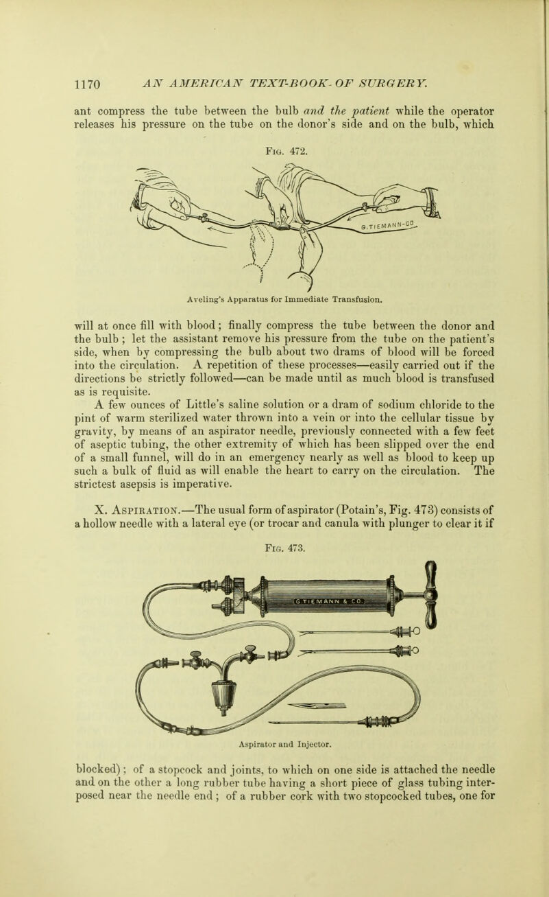 ant compress the tube between the bulb and the patient while the operator releases his pressure on the tube on the donor's side and on the bulb, which Fig. 472. Aveling's Apparatus for Immediate Transfusion. will at once fill with blood; finally compress the tube between the donor and the bulb ; let the assistant remove his pressure from the tube on the patient's side, when by compressing the bulb about two drams of blood will be forced into the circulation. A repetition of these processes—easily carried out if the directions be strictly followed—can be made until as much blood is transfused as is requisite. A few ounces of Little's saline solution or a dram of sodium chloride to the pint of warm sterilized water thrown into a vein or into the cellular tissue by gravity, by means of an aspirator needle, previously connected with a few feet of aseptic tubing, the other extremity of which has been slipped over the end of a small funnel, will do in an emergency nearly as well as blood to keep up such a bulk of fluid as will enable the heart to carry on the circulation. The strictest asepsis is imperative. X. Aspiration.—The usual form of aspirator (Potain's, Fig. 473) consists of a hollow needle with a lateral eye (or trocar and canula with plunger to clear it if Fio. 473. Aspirator and Injector. blocked) ; of a stopcock and joints, to which on one side is attached the needle and on the other a long rubber tube having a short piece of glass tubing inter- posed near the needle end ; of a rubber cork with two stopcocked tubes, one for