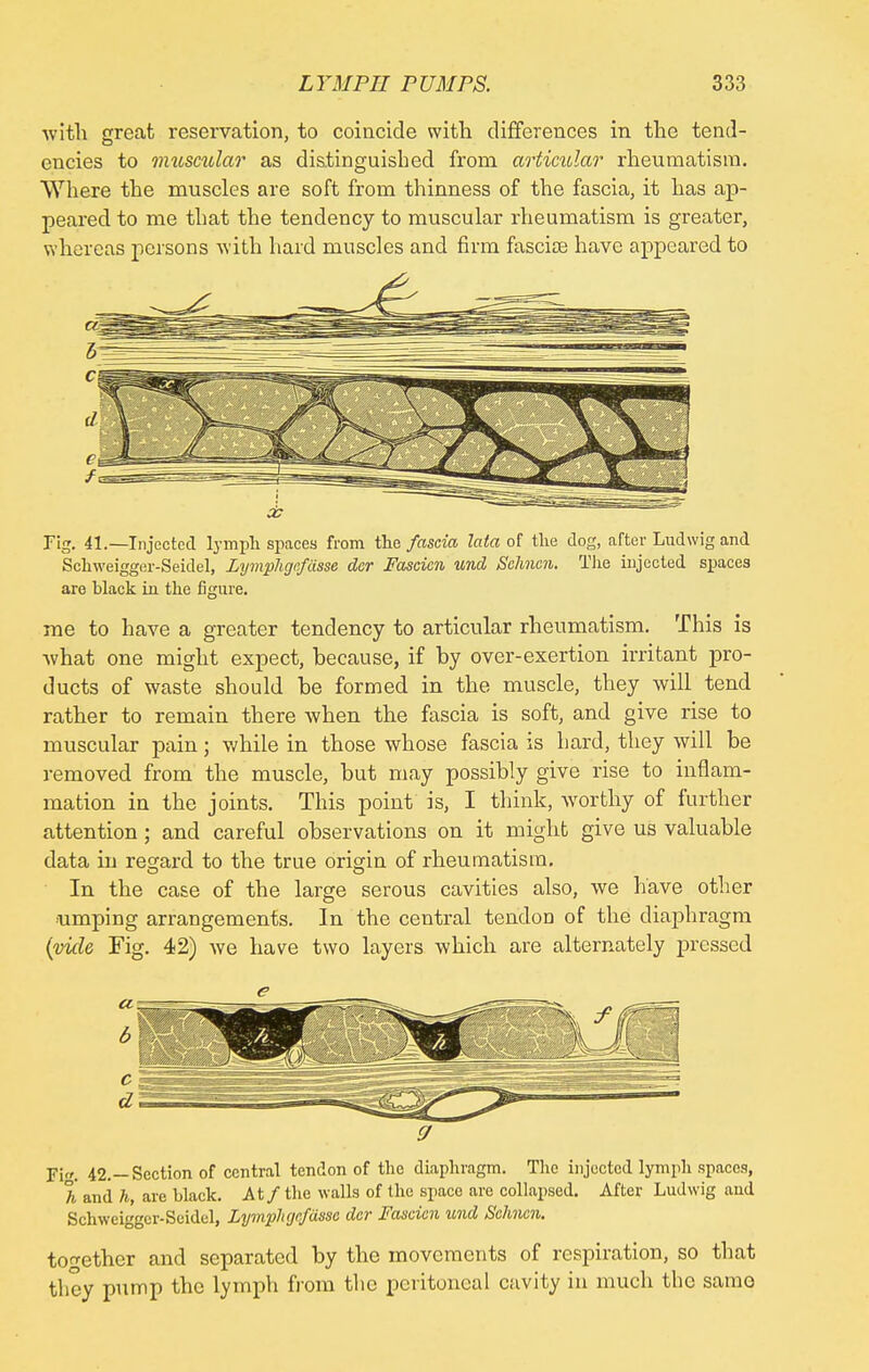 with great reservation, to coincide with differences in the tend- encies to nuiscular as distinguished from articular rheumatism. Where the muscles are soft from thinness of the fascia, it has ap- peared to me that the tendency to muscular rheumatism is greater, whereas persons with hard muscles and firm fascia? have appeared to Tig. 41.— Injected lymph spaces from the fascia lata of the dog, after Ludwig and Schweigger-Seidel, Lymphgrfcisse dcr Fascicn und Schncn. The injected spaces are hlack in the figure. me to have a greater tendency to articular rheumatism. This is •what one might expect, because, if by over-exertion irritant pro- ducts of waste should be formed in the muscle, they will tend rather to remain there when the fascia is soft, and give rise to muscular pain; while in those whose fascia is hard, they will be removed from the muscle, but may possibly give rise to inflam- mation in the joints. This point is, I think, worthy of further attention ; and careful observations on it might give us valuable data in regard to the true origin of rheumatism. In the case of the large serous cavities also, we have other ■urnping arrangements. In the central tendon of the diaphragm (vide Fig. 42) we have two layers which are alternately pressed r 9 Fi. 42.—Section of central tendon of the diaphragm. The injected lymph spaces, A and h, are black. At / the walls of the space are collapsed. After Ludwig and Schweigger-Seidel, Lymphgefasse dcr Fascicn und Schncn. together and separated by the movements of respiration, so that they pump the lymph from the peritoneal cavity in much the same-