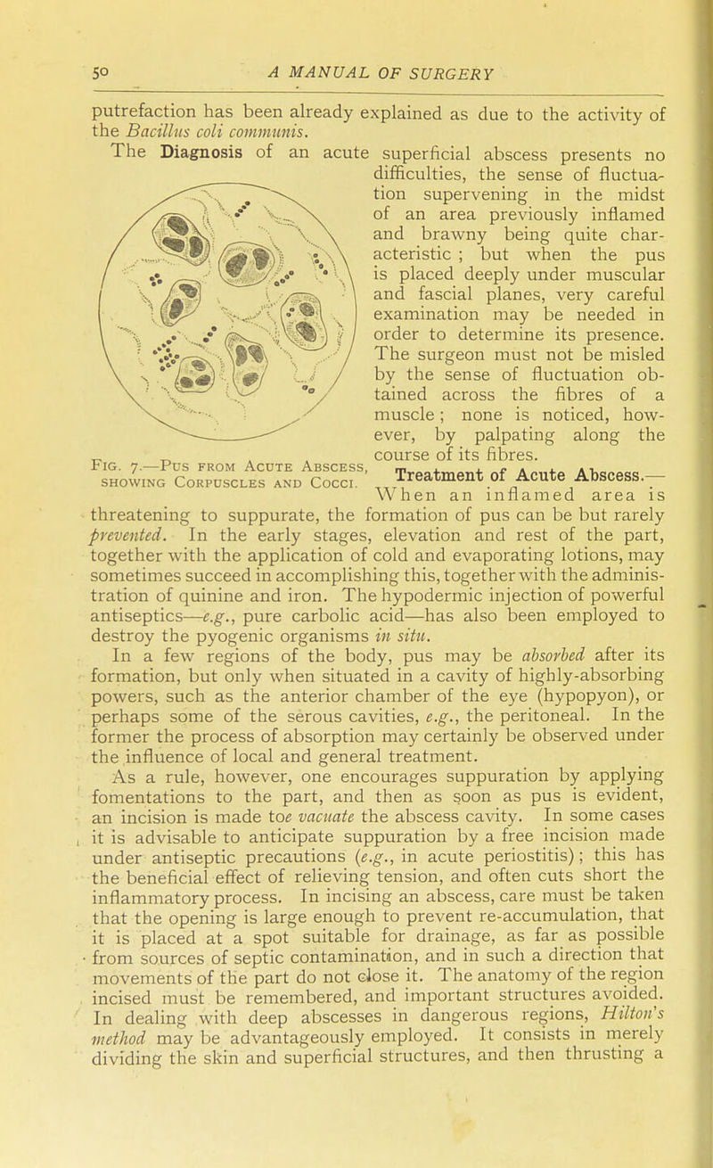 putrefaction has been already explained as due to the activity of the Bacillus coli communis. threatening to suppurate, the formation of pus can be but rarely prevented. In the early stages, elevation and rest of the part, together with the application of cold and evaporating lotions, may sometimes succeed in accomplishing this, together with the adminis- tration of quinine and iron. The hypodermic injection of powerful antiseptics—e.g., pure carbolic acid—has also been employed to destroy the pyogenic organisms in situ. In a few regions of the body, pus may be absorbed after its formation, but only when situated in a cavity of highly-absorbing powers, such as the anterior chamber of the eye (hypopyon), or perhaps some of the serous cavities, e.g., the peritoneal. In the former the process of absorption may certainly be observed under the influence of local and general treatment. As a rule, however, one encourages suppuration by applying fomentations to the part, and then as soon as pus is evident, an incision is made toe vacuate the abscess cavity. In some cases it is advisable to anticipate suppuration by a free incision made under antiseptic precautions (e.g., in acute periostitis); this has the beneficial effect of relieving tension, and often cuts short the inflammatory process. In incising an abscess, care must be taken that the opening is large enough to prevent re-accumulation, that it is placed at a spot suitable for drainage, as far as possible from sources of septic contamination, and in such a direction that movements of the part do not close it. The anatomy of the region incised must be remembered, and important structures avoided. In dealing with deep abscesses in dangerous regions, Hilton's method may be advantageously employed. It consists in merely dividing the skin and superficial structures, and then thrusting a The Diagnosis of an acute superficial abscess presents no difficulties, the sense of fluctua- tion supervening in the midst of an area previously inflamed and brawny being quite char- acteristic ; but when the pus is placed deeply under muscular and fascial planes, very careful examination may be needed in order to determine its presence. The surgeon must not be misled by the sense of fluctuation ob- tained across the fibres of a muscle; none is noticed, how- ever, by palpating along the course of its fibres. Fig. 7.—Pus from Acute Abscess, showing Corpuscles and Cocci. Treatment of Acute Abscess.— When an inflamed area is