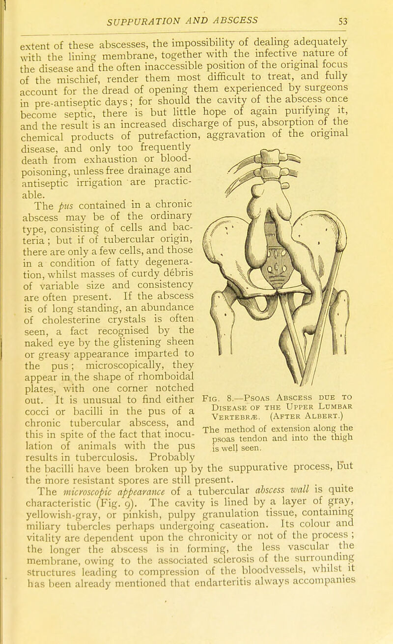 extent of these abscesses, the impossibility of dealing adequately with the lining membrane, together with the infective nature of the disease and the often inaccessible position of the original focus of the mischief, render them most difficult to treat, and fully account for the dread of opening them experienced by surgeons in pre-antiseptic days; for should the cavity of the abscess once become septic, there is but little hope of again purifying it, and the result is an increased discharge of pus, absorption of the chemical products of putrefaction, aggravation of the original disease, and only too frequently death from exhaustion or blood- poisoning, unless free drainage and antiseptic irrigation are practic- able. The pus contained in a chronic abscess may be of the ordinary type, consisting of cells and bac- teria ; but if of tubercular origin, there are only a few cells, and those in a condition of fatty degenera- tion, whilst masses of curdy debris of variable size and consistency are often present. If the abscess is of long standing, an abundance of cholesterine crystals is often seen, a fact recognised by the naked eye by the glistening sheen or greasy appearance imparted to the pus; microscopically, they appear in the shape of rhomboidal plates, with one corner notched out. It is unusual to find either cocci or bacilli in the pus of a chronic tubercular abscess, and this in spite of the fact that inocu- lation of animals with the pus results in tuberculosis. Probably the bacilli have been broken up by the suppurative process, But the more resistant spores are still present. The microscopic appearance of a tubercular abscess wall is quite characteristic (Fig. 9). The cavity is lined by a layer of gray, yellowish-gray, or pinkish, pulpy granulation tissue, containing miliary tubercles perhaps undergoing caseation. Its colour and vitality are dependent upon the chronicity or not of the process ; the longer the abscess is in forming, the less vascular the membrane, owing to the associated sclerosis of the surrounding structures leading to compression of the bloodvessels, whilst it has been already mentioned that endarteritis always accompanies Fig. 8.—Psoas Abscess due to Disease of the Upper Lumbar Vertebrae. (After Albert.) The method of extension along the psoas tendon and into the thigh is well seen.