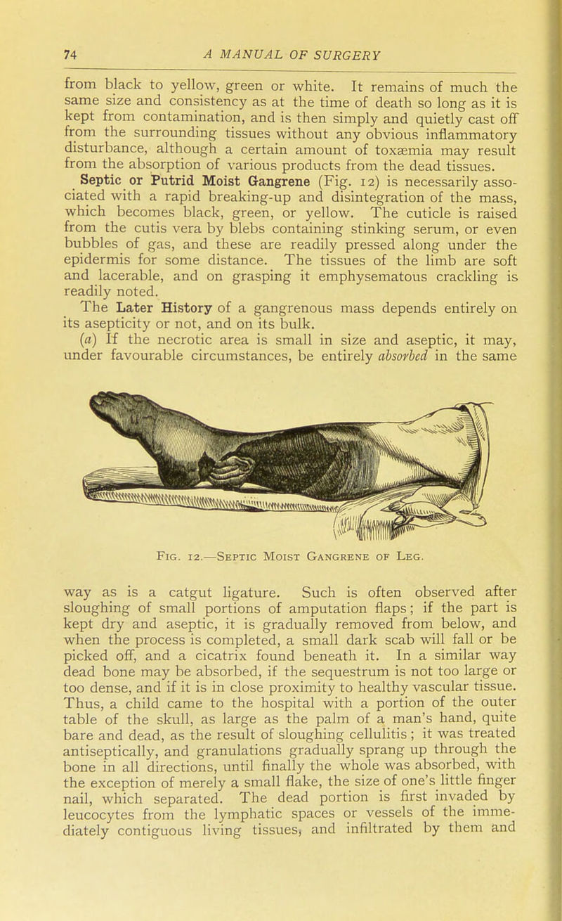 from black to yellow, green or white. It remains of much the same size and consistency as at the time of death so long as it is kept from contamination, and is then simply and quietly cast off from the surrounding tissues without any obvious inflammatory disturbance, although a certain amount of toxaemia may result from the absorption of various products from the dead tissues. Septic or Putrid Moist Gangrene (Fig. 12) is necessarily asso- ciated with a rapid breaking-up and disintegration of the mass, which becomes black, green, or yellow. The cuticle is raised from the cutis vera by blebs containing stinking serum, or even bubbles of gas, and these are readily pressed along under the epidermis for some distance. The tissues of the limb are soft and lacerable, and on grasping it emphysematous crackling is readily noted. The Later History of a gangrenous mass depends entirely on its asepticity or not, and on its bulk. (a) If the necrotic area is small in size and aseptic, it may, under favourable circumstances, be entirely absorbed in the same Fig. 12.—Septic Moist Gangrene of Leg. way as is a catgut ligature. Such is often observed after sloughing of small portions of amputation flaps; if the part is kept dry and aseptic, it is gradually removed from below, and when the process is completed, a small dark scab will fall or be picked off, and a cicatrix found beneath it. In a similar way dead bone may be absorbed, if the sequestrum is not too large or too dense, and if it is in close proximity to healthy vascular tissue. Thus, a child came to the hospital with a portion of the outer table of the skull, as large as the palm of a man's hand, quite bare and dead, as the result of sloughing cellulitis; it was treated antiseptically, and granulations gradually sprang up through the bone in all directions, until finally the whole was absorbed, with the exception of merely a small flake, the size of one's little finger nail, which separated. The dead portion is first invaded by leucocytes from the lymphatic spaces or vessels of the imme- diately contiguous living tissues, and infiltrated by them and