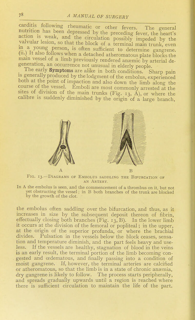 7« carditis following rheumatic or other fevers. The general nutrition has been depressed by the preceding fever, the heart's action is weak, and the circulation possibly impeded by the valvular lesion, so that the block of a terminal main trunk, even w/°,Un? Person> 15 often sufficient to determine gangrene. (11.) It also follows when a detached atheromatous plate blocks the mam vessel of a limb previously rendered anaemic by arterial de- generation, an occurrence not unusual in elderly people. _ The early Symptoms are alike in both conditions. Sharp pain is generally produced by the lodgment of the embolus, experienced both at the point of impaction and also down the limb along the course of the vessel. Emboli are most commonly arrested at the sites of division of the main trunks (Fig. 13, A), or where the calibre is suddenly diminished by the origin of a large branch, B Fig. 13.—Diagrams of Embolus saddling the Bifurcation of an Artery. In A the embolus is seen, and the commencement of a thrombus on it, but not yet obstructing the vessel; in B both branches of the trunk are blocked by the growth of the clot. the embolus often saddling over the bifurcation, and thus, as it increases in size by the subsequent deposit thereon of fibrin, effectually closing both branches (Fig. 13, B). In the lower limb it occurs at the division of the femoral or popliteal; in the upper, at the origin of the superior profunda, or where the brachial divides. Pulsation in the vessels below the block ceases, sensa- tion and temperature diminish, and the part feels heavy and use- less. If the vessels are healthy, stagnation of blood in the veins is an early result, the terminal portion of the limb becoming con- gested and cedematous, and finally passing into a condition of moist gangrene. If, however, the terminal arteries are calcified or atheromatous, so that the limb is in a state of chronic anasmia, dry gangrene is likely to follow. The process starts peripherally, and spreads gradually upwards until a region is reached where there is sufficient circulation to maintain the life of the part.