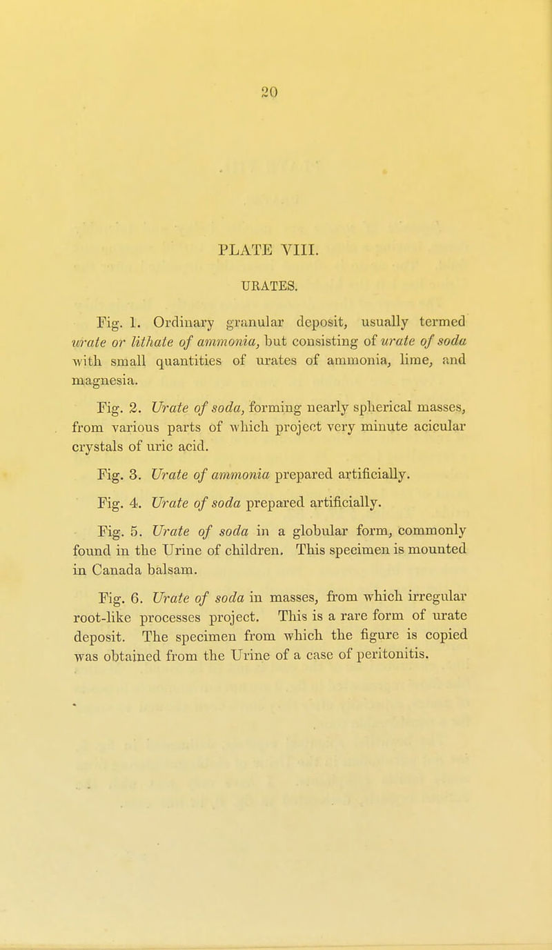 PLATE VIII. URATES. Fig. 1. Ordinary granular deposit, usually termed urate or lithate of ammonia, but consisting of urate of soda with small quantities of urates of ammonia, lime, and magnesia. Fig. 2. Urate of soda, forming nearly spherical masses, from various parts of which project very minute acicular crystals of uric acid. Fig. 3. Urate of ammonia prepared artificially. Fig. 4. Urate of soda prepared artificially. Fig. 5. Urate of soda in a globular form, commonly found in the Urine of children. This specimen is mounted in Canada balsam. Fig. 6. Urate of soda in masses, from which irregular root-like processes project. This is a rare form of urate deposit. The specimen from which the figure is copied was obtained from the Urine of a case of peritonitis.