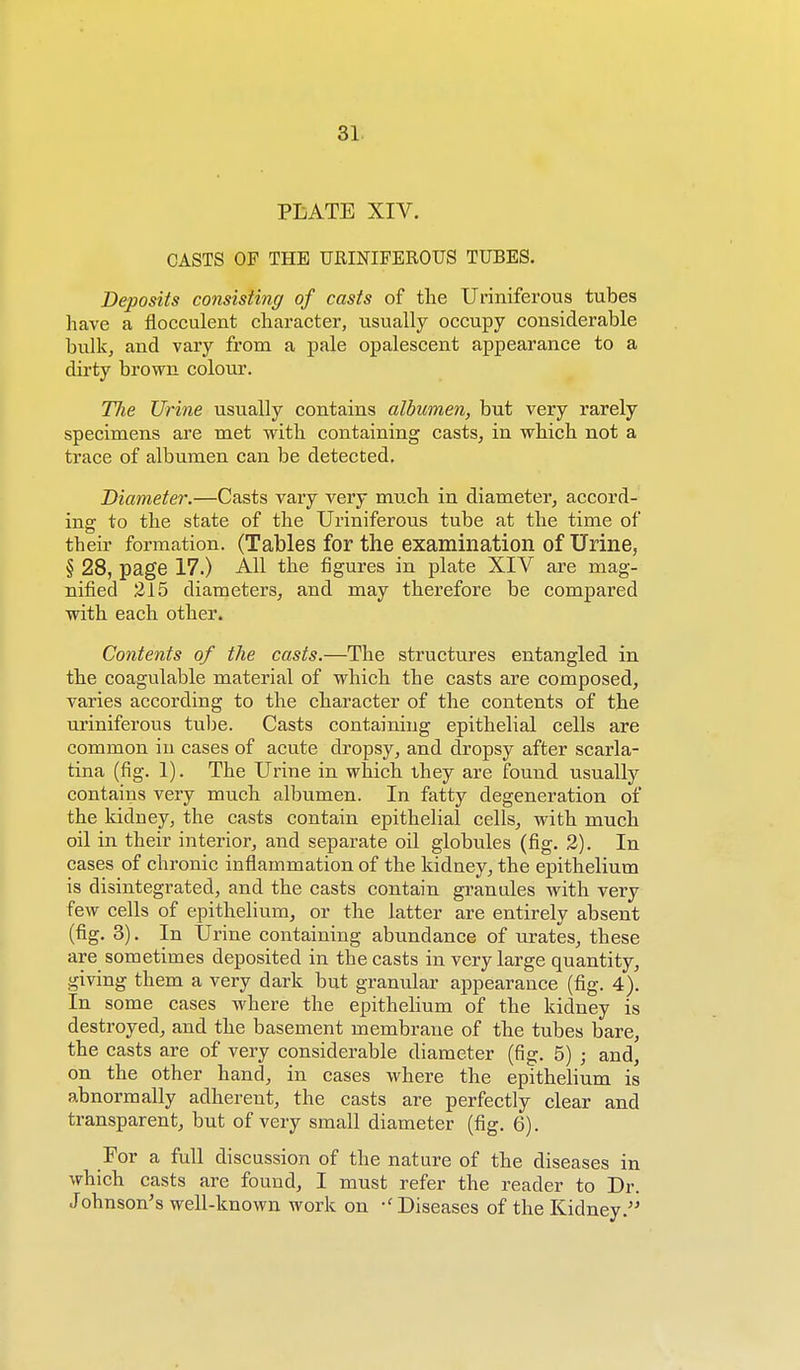 PLATE XIV. CASTS OF THE URINIFEROUS TUBES. Deposits consisting of casts of the Uriniferous tubes have a flocculent character, usually occupy considerable bulk, and vary from a pale opalescent appearance to a dirty brown colour. The Urine usually contains albumen, but very rarely specimens are met with containing casts, in which not a trace of albumen can be detected. Diameter.—Casts vary very much in diameter, accord- ing to the state of the Uriniferous tube at the time of their formation. (Tables for the examination of Urine, § 28, page 17.) All the figures in plate XIV are mag- nified 215 diameters, and may therefore be compared with each other. Contents of the casts.—The structures entangled in the coagulable material of which the casts are composed, varies according to the character of the contents of the uriniferous tube. Casts containing epithelial cells are common in cases of acute dropsy, and dropsy after scarla- tina (fig. 1). The Urine in which they are found usually contains very much albumen. In fatty degeneration of the kidney, the casts contain epithelial cells, with much oil in their interior, and separate oil globules (fig. 2). In cases of chronic inflammation of the kidney, the epithelium is disintegrated, and the casts contain granules with very few cells of epithelium, or the latter are entirely absent (fig. 3). In Urine containing abundance of urates, these are sometimes deposited in the casts in very large quantity, giving them a very dark but granular appearance (fig. 4). In some cases where the epithelium of the kidney is destroyed, and the basement membrane of the tubes bare, the casts are of very considerable diameter (fig. 5) ; and, on the other hand, in cases where the epithelium is abnormally adherent, the casts are perfectly clear and transparent, but of very small diameter (fig. 6). For a full discussion of the nature of the diseases in which casts are found, I must refer the reader to Dr. Johnson's well-known work on Diseases of the Kidney.