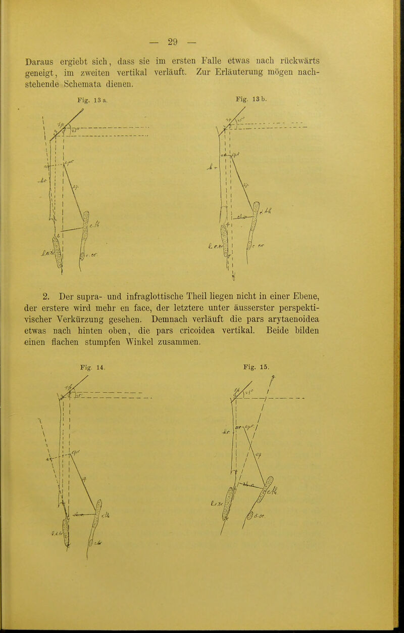 Daraus ergiebt sich, dass sie im ersten Falle etwas uacli rückwärts geneigt, im zweiten vertikal verläuft. Zur Erläuterung mögen nacli- stehende Schemata dienen. Fig. 13 a. Fig. 13 b. 2. Der supra- und infraglottische Theil liegen nicht in einer Ebene, der erstere wird mehr en face, der letztere unter äusserster perspekti- vischer Verkürzung gesehen. Demnach verläuft die pars arytaenoidea etwas nach hinten oben, die pars cricoidea vertikal. Beide bilden einen flachen stumpfen Winkel zusammen. Fig. 14. Fig. 15.