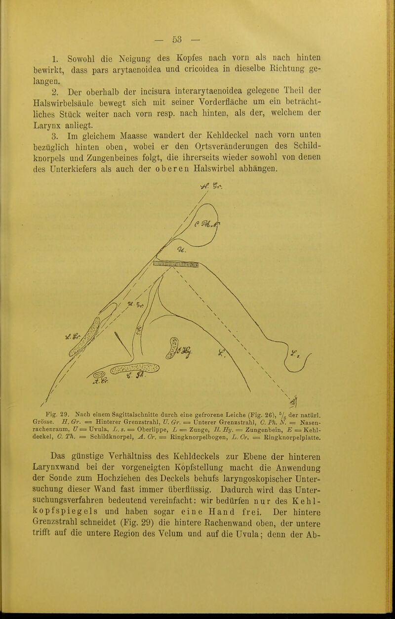 1. Sowohl die Neigung des Kopfes nach vorn als nach hinten bewirkt, dass pars arytaenoidea und cricoidea in dieselbe Richtung ge- langen. 2. Der oberhalb der incisura interarytaenoidea gelegene Theil der Halswirbelsäule bewegt sich mit seiner Vorderfläche um ein beträcht- liches Stück weiter nach vorn resp. nach hinten, als der, welchem der Larynx anliegt. 3. Im gleichem Maasse wandert der Kehldeckel nach vorn unten bezüglich hinten oben, wobei er den Ortsveränderungen des Schild- knorpels und Zungenbeines folgt, die ihrerseits wieder sowohl von denen des Unterkiefers als auch der oberen Halswirbel abhängen. Das günstige Verhältniss des Kehldeckels zur Ebene der hinteren Larynxwand bei der vorgeneigten Kopfstellung macht die Anwendung der Sonde zum Hochziehen des Deckels behufs laryngoskopischer Unter- suchung dieser Wand fast immer überflüssig. Dadurch wird das Unter- suchungsverfahren bedeutend vereinfacht: wir bedürfen nur des Kehl- kopfspiegels und haben sogar eine Hand frei. Der hintere Grenzstrahl schneidet (Fig. 29) die hintere Rachenwand oben, der untere trifft auf die untere Region des Velum und auf die Uvula; denn der Ab-