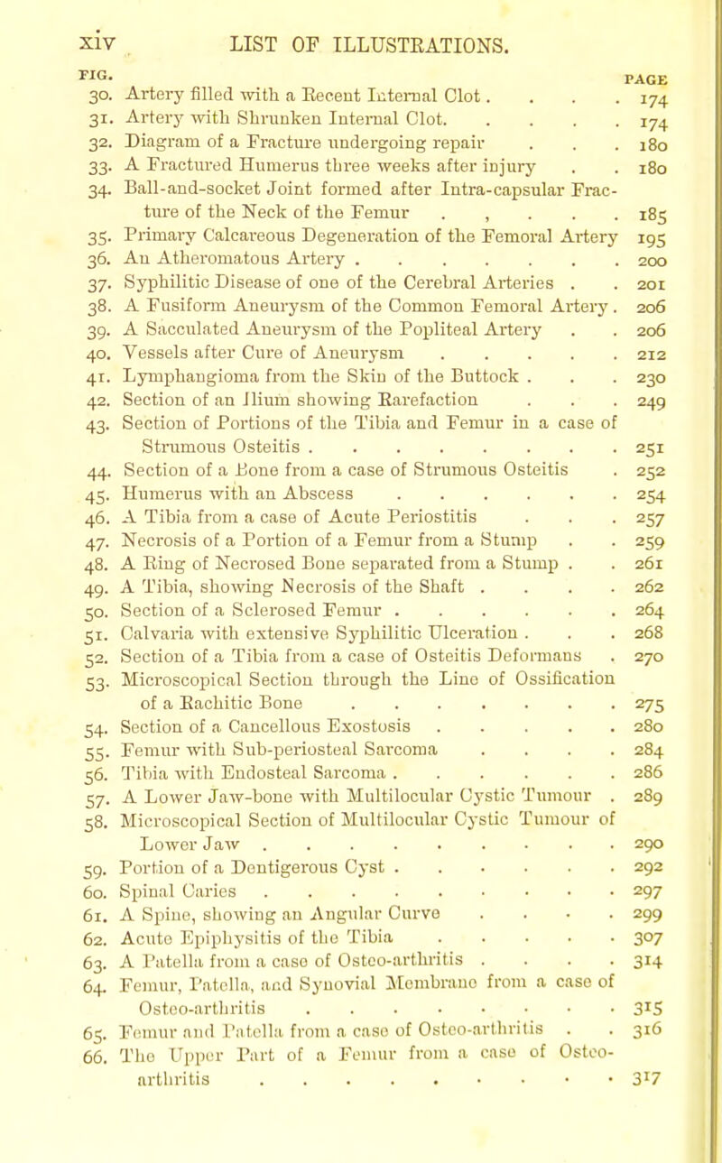 FAG£ 30. Artery filled with a Eeeent Iiitemal Clot.... 174 31. Arterj' with Shrunken Internal Clot 174 32. Diagram of a Fracture undergoing repair . . . 180 33. A Fractured Humerus tbree weeks after injury . . 180 34. Ball-and-socket Joint formed after lutra-capsular Frac- tnre of the Neck of the Femur 185 35. Primai-y Calcareous Degeneration of the Femoral Artery 195 36. An Atheromatous Artery 200 37. Syphilitic Disease of one of the Cerebral Arteries . . 201 38. A Fusiform Aneurysm of the Common Femoral Arterj'. 206 39. A Sacculated Aneurysm of the Popliteal Artery . . 206 40. Vessels after Cure of Aneurysm 212 41. LjTuphangioma from the Skin of the Buttock . . . 230 42. Section of an Jlium showing Rarefaction . . . 249 43. Section of Portions of the Tibia and Femur in a case of Strumous Osteitis 251 44. Section of a Bone from a case of Strumous Osteitis . 252 45. Humerus with an Abscess 254 46. A Tibia fronr a case of Acute Periostitis . . . 257 47. Necrosis of a Portion of a Femur from a Stump . . 259 48. A Eing of Necrosed Bone separated from a Stump . . 261 49. A Tibia, showing Necrosis of the Shaft .... 262 50. Section of a Sclerosed Femur 264 51. Calvaria with extensive Syphilitic Ulceration . . . 268 52. Section of a Tibia from a case of Osteitis Deformans . 270 53. Microscoiaical Section through the Line of Ossification of a Eachitic Bone 275 54. Section of a Cancellous Exostosis 280 55. Femur with Sub-periosteal Sarcoma .... 284 56. Tibia with Endosteal Sarcoma 286 57. A Lower Jaw-bone with Multilocular Cystic Tumour . 289 58. Microscopical Section of Multilocular Cystic Tumour of Lower Jaw 290 59. Portion of a Dentigerous Cyst 292 60. Spinal Caries 297 61. A Spine, showing an Angular Curve .... 299 62. Acute Epiphysitis of the Tibia 307 63. A Patella from a case of Ostco-arthi-itis .... 314 64. Femur, Patella, and Synovial Membrane from a case of Osteo-arthritis 3^5 65. Femur and Patella from a case of Osteo-arlhrilis . . 316 66. The Upper Part of a Femur from a case of Osteo- arthritis 317