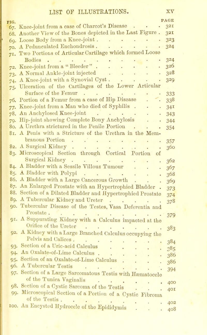FIG. TAGE 67. Knee-joint from a case of Oliarcot's Disease . . . 321 68. Another View of the Bones depicted in the Last Figure . 321 69. Loose Body from a Knee-joint 323 70. A Pedunculated Enchondrosis 324 71. Two Portions of Articular Cartilage which fonned Loose Bodies 324 72. Knee-joint from a  Bleeder  326 73. A Normal Ankle-joint injected 328 74. A Knee-joint with a Synovial Cyst 329 75. Ulceration of the Cartilages of the Lower Articular Surface of the Femur 333 76. Portion of a Femur from a case of Hip Disease . . 338 77. Knee-joint from a Man who died of Syphilis . . . 341 78. An A.nchylosed Knee-joint 343 79. Hip-joint showing Complete Bony Anchylosis . . 344 80. A Urethra strictured in the Penile Portion . . . 354 81. A Penis with a Stricture of the Urethra in the Mem- branous Portion . .' 357 82. A Surgical Kidney ........ 360 83. Microscopical Section through Cortical Portion of Surgical Kidney 362 84. A Bladder with a Sessile Villous Tumour . . . 367 85. A Bladder with Polj-pi 368 86. A Bladder with a Large Cancerous Gi-owth . . . 369 87. An Enlarged Prostate with an Hypertrophied Bladder . 373 88. Section of a Dilated Bladder and Hypertrophied Prostate 374 89. A Tubercular Kidney and Ureter 378 90. Tubercular Disease of the Testes, Vasa Deforentia and Prostate .......... 379 91. A Suppurating Kidney with a Calculus impacted at the Orifice of the Ureter 383 92. A Kidney with a Large Branched Calculus occupying the Pelvis and Calices gg^ 93. Section of a Uric-aeid Calculus ^85 94. An Oxalate-of-Lime Calculus ^86 95. Section of an Oxalate-of-Lime Calculus .... 386 96. A Tubercular Testis _ 97. Section of a Largo Sarcomatous Testis with Hrematocele of the Tunica Vaginalis 98. Section of a Cystic Sarcoma of the Testis . . .401 99. Microscopical Section of a Portion of a Cystic Fibroma of the Testis . 100. An Encysted Hydrocele of the Epididymis . . .408