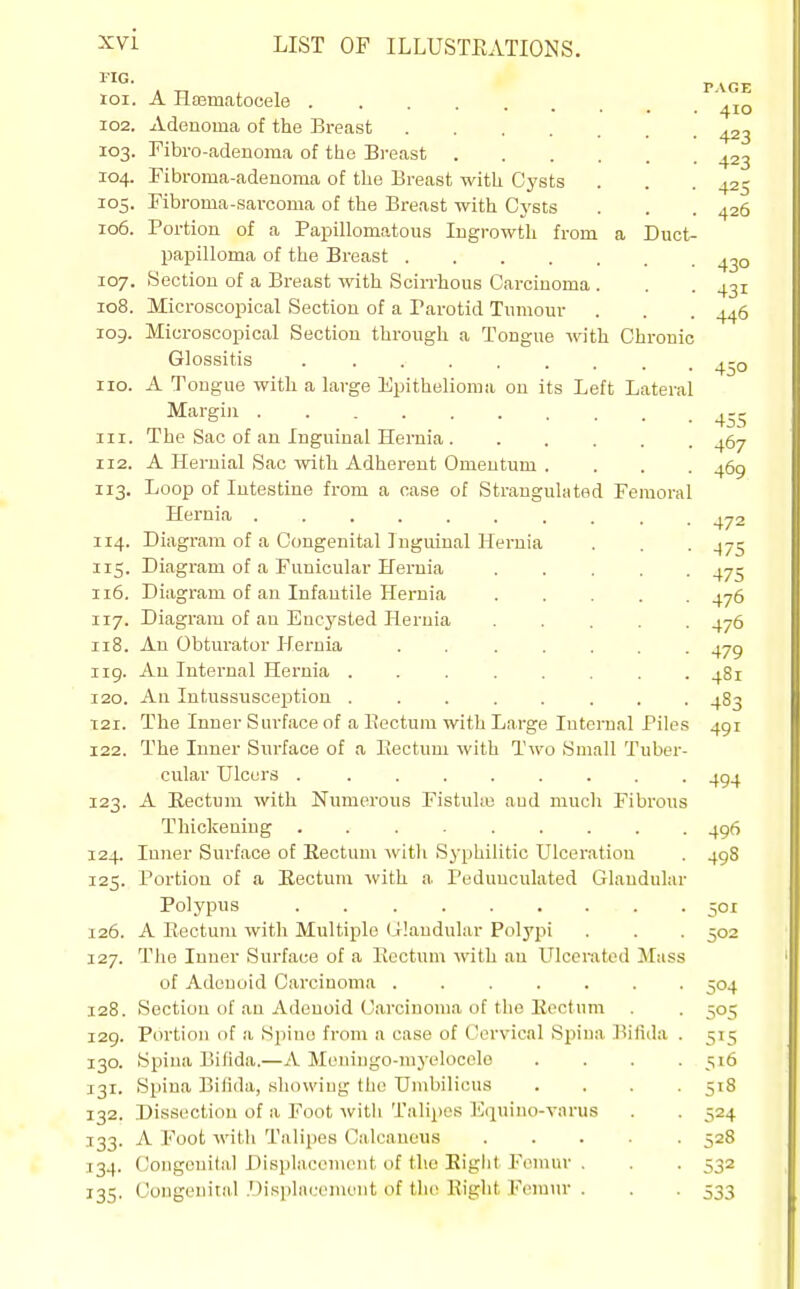™- PVGE 101. A Haamatocele . . 102. Adenoma of the Breast ^23 103. ribro-adenoma of the Breast ^23 104. Fibroma-adeuoma of the Breast with Cysts . . . 425 105. Fibroma-sarcoma of the Breast with Cysts . . . 426 106. Portion of a Papillomatous Ingrowth from a Duct- papilloma of the Breast 4^0 107. Section of a Breast with Scin-hous Carcinoma . . . 431 108. Microscopical Section of a Pai-otid Tumour . . . 446 109. Microscopical Section through a Tongue with Chronic Glossitis 4-Q 110. A Tongue with a large Epithelioma on its Left Lateral ^'^'■g! 455 111. The Sac of an Inguinal Hernia 467 112. A Hernial Sac with Adherent Omentum .... 469 113. Loop of Intestine from a case of Strangulated Femoral Hernia 472 114. Diagram of a Congenital Inguinal Hernia . . -475 115. Diagram of a Funicular Hernia 475 116. Diagram of an Infantile Hernia 476 117. Diagram of an Encysted Hernia 476 118. An Obturator Hernia . 479 119. An Internal Hernia 481 120. An IntussusceiJtion 483 T2I. The Inner Surface of a Eectum with Large Internal Piles 491 122. The Inner Surface of a IJectum with Two Small Tuber- cular Ulcers 494 123. A Eectum with Numerous Fistuke aud much Fibrous Thickening 496 124. Inner Surface of Eectum with S^-philitic Ulceration . 498 125. Portion of a Eectum with a Pedunculated Glandular Polypus 501 126. A Eectum with Multiple Glandular Polypi . . . 502 127. The Inner Surface of a Eectum with an Ulcerated Mass of Adenoid Carcinoma ....... 504 128. Section of an Adenoid Carcinoma of the Eectum . . 505 129. Portion of a Spine from a case of Cervical Spina Bifida . 515 130. Spina Bifida.—A Moniugo-myelocele . . . . 516 131. Spina Bifida, showing the Umbilicus .... 518 132. Dissection of a Foot with Talipes l'j(piiiio-varus . . 524 T33. A Foot with Talipes Calcaneus 528 134. Congenital Displacement of the Bight J'emuv . . . 532 135. Congenital .Displacement of the Eight Femur . . . 533