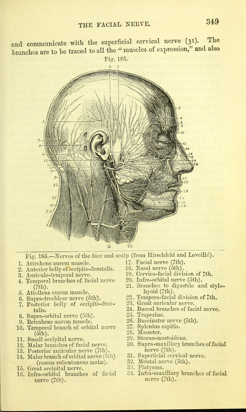 Fig. 185.—Nerves of the face and sc; 1. Attrahens aurem muscle. 2. Anterior belly of occipito-frontalis. 3. Auriculo-temporal nerve. 4. Temporal branches of facial nerve (7th). 5. Attollens aurem muscle. 6. Supra-trochlear nerve (5th). 7. Posterior belly of occipito-fron- talis. 8. Supra-orbital nerve (5th). 9. Ketrahens aurem muscle. 10. Temporal branch of orbital nerve (5th). 11. Small occipital nerve. 12. Malar branches of facial nerve. 13. Posterior auricular nerve (7th). 14. Malar branch of orbital nerve (5th) (ramus subcutaneus niahe). 15. Great occipital nerve. 16. Infra-orbital branches of facial nerve (7th). ilp (from Hirschfelcl and Leveille). 17- Facial nerve (7th). 18. Nasal nerve (5th). 19. Cervico-faclal division of 7th. 20. Infra-orbital nerve (5th). 21. Branches to digastric and stylo- hyoid (7th). 22. Temporo-facial division of 7th. 23. Great auricular nerve. 24. Buccal branches of facial nerve. 25. Trapezius. 26. Buccinator nerve (5th). 27- Splenius capitis. 28. Masseter. 29. Sterno-mastoidcus. Supra-maxillary branches of facial nerve (7th). Superficial cervical nerve. Mental nerve (5th). 33. Platysma. 34. Infra-maxillary branches of facial nerve (7th). 30. 31. 32.