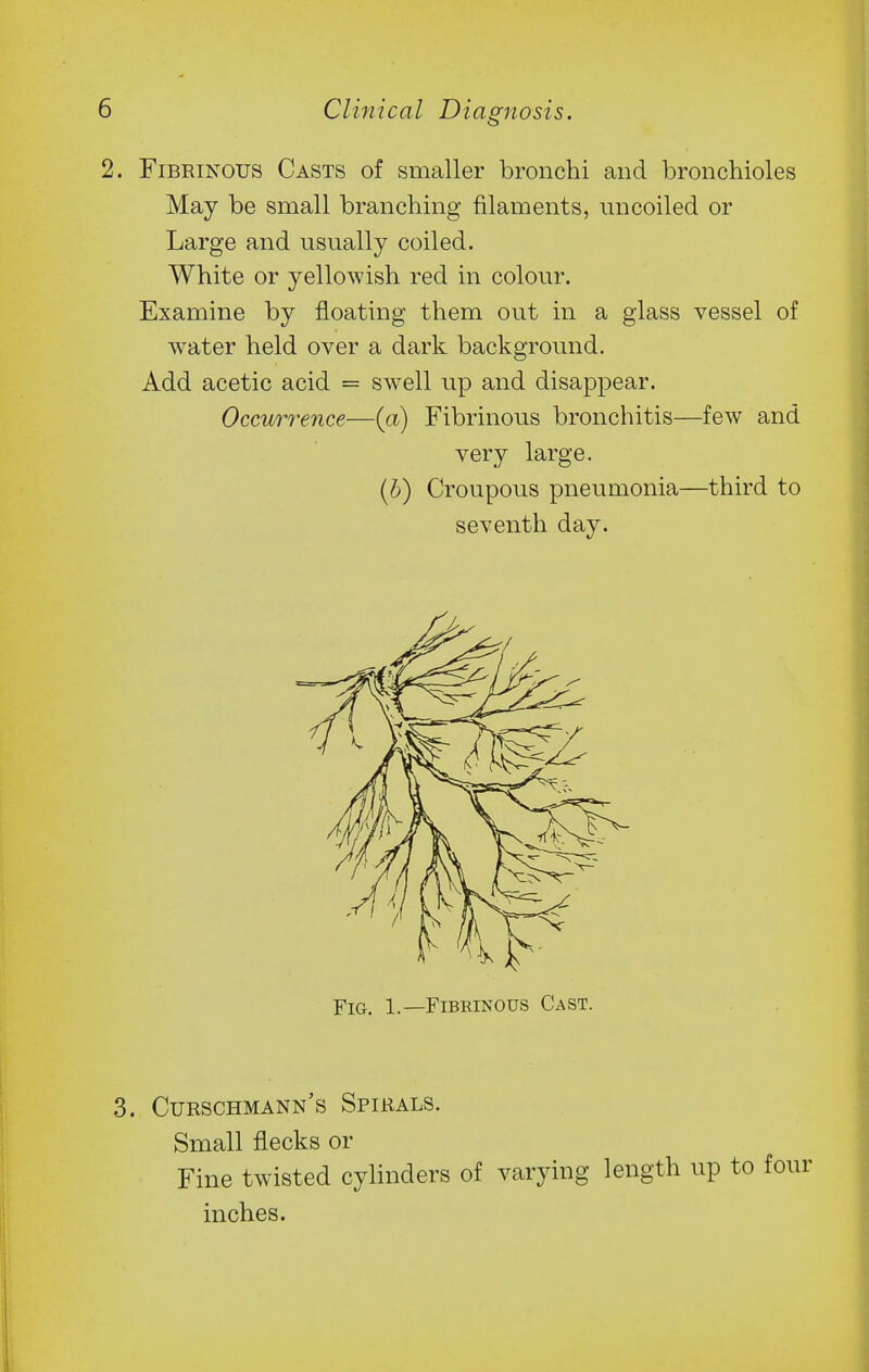 Fibrinous Casts of smaller bronchi and bronchioles May be small branching filaments, uncoiled or Large and usually coiled. White or yellowish red in colour. Examine by floating them out in a glass vessel of water held over a dark background. Add acetic acid = sw^ell up and disappear. Occurrence—{a) Fibrinous bronchitis—few and very large. {b) Croupous pneumonia—third to seventh day. Fig. 1.—Fibrinous Cast. Curschmann's Spirals. Small flecks or Fine twisted cylinders of varying length up to four inches.