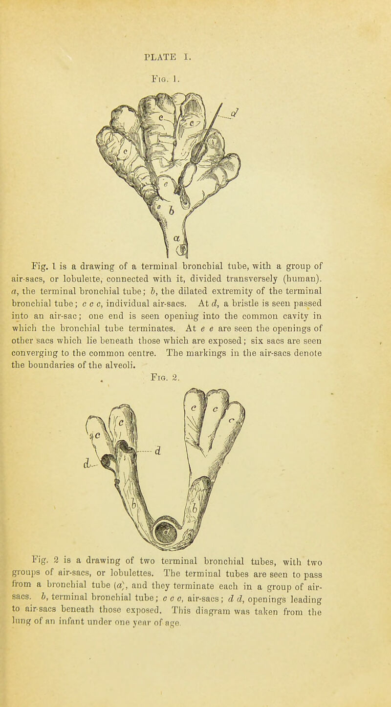 Fig. 1. Fig. I is a drawing of a terminal bronchial tube, with a group of air sacs, or lobuleite, connected with it, divided transversely (human). a, the terminal bronchial tube; b, the dilated extremity of the terminal bronchial tube; c a c, individual air-sacs. At d, a bristle is seen passed into an air-sac; oue end is seen opening into the common cavity in which the bronchial tube terminates. At e e are seen the openings of other sacs which lie beneath those which are exposed; six sacs are seen converging to the common centre. The markings in tlie air-sacs denote the boundaries of the alveoli. Fig. 2. Fig. 2 is a drawing of two terminal bronchial tubes, with two groups of air-sacs, or lobulettes. The terminal tubes are seen to pass from a bronchial tube (a], and they terminate each in a group of air- sacs, h, terminal bronchial tube; ceo, air-sacs; d d, openings leading to air sacs beneath those exposed. This dingram was taken from the lung of an infant under one year of a^e