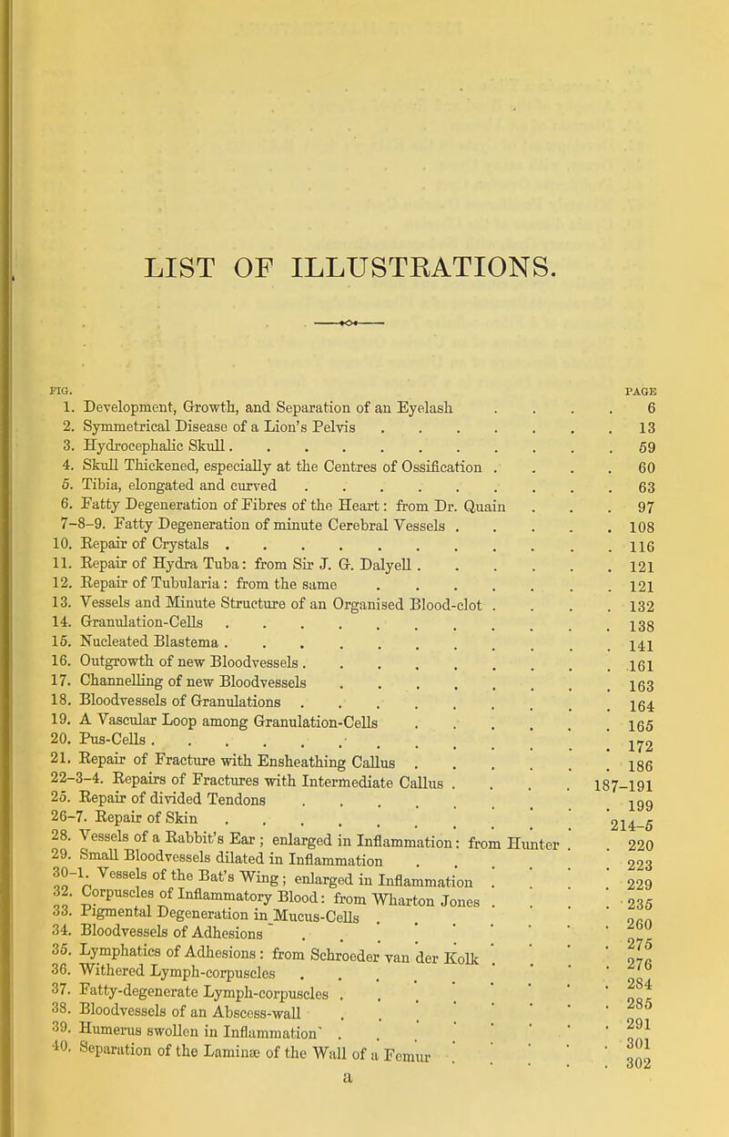 LIST OF ILLUSTRATIONS. FIG. 1. 2. 3. 4. 5. 6. 7- 10. 11. 12. 13. 14. 15. 16. 17. 18. 19. 20. 21. 22- 25. 26- 28. 29. 30- 32. 33. 34. 35. 36. 37. 38. 39. 40. CeUs Development, Growth, and Separation of an Eyelash Symmetrical Disease of a Lion's Pelvis .... Hydrocephalic Skull........ SkuU Thickened, especially at the Centres of Ossification . Tibia, elongated and curved ...... Patty Degeneration of Pibres of the Heart: from Dr. Quain ■8-9. Fatty Degeneration of minute Cerebral Vessels . Eepair of Crystals ........ Eepair of Hydra Tuba: from Sir J. G. DalyeU . Eepair of Tubularia: from the same .... Vessels and Minute Structure of an Organised Blood-clot . Granulation-Cells Nucleated Blastema . Outgrowth of new Bloodvessels. Channelling of new Bloodvessels Bloodvessels of Granulations . A Vascular Loop among Granulation- Pus-Cells Eepair of Fracture with Ensheathing Callus . 3-4. Eepairs of Fractures with Intermediate Callus Eepair of divided Tendons .... 7. Eepair of Skin Vessels of a Eabbit's Ear ; enlarged in Inflammation: from Small Bloodvessels dilated in Inflammation ■1. Vessels of the Bat's Wing; enlarged in Inflammation Corpuscles of Inflammatory Blood: from Wharton Jones Pigmental Degeneration in Mucus-CeUs Bloodvessels of Adhesions . . ' '  Lymphatics of Adhesions: from Schroeder van der KoUc Withered Lymph-corpuscles • • . . Fatty-degenerate Lymph-corpuscles . Bloodvessels of an Abscess-waU . . ' ' Humerus swollen in Inflammation ... Separation of the Laminae of the Wall of a Fomiir a Hunter PAGE 6 13 59 60 63 97 108 116 121 121 132 138 141 .161 163 164 165 172 186 187-191 199 214-5 220 223 229 •235 260 275 276 284 285 291 301 302