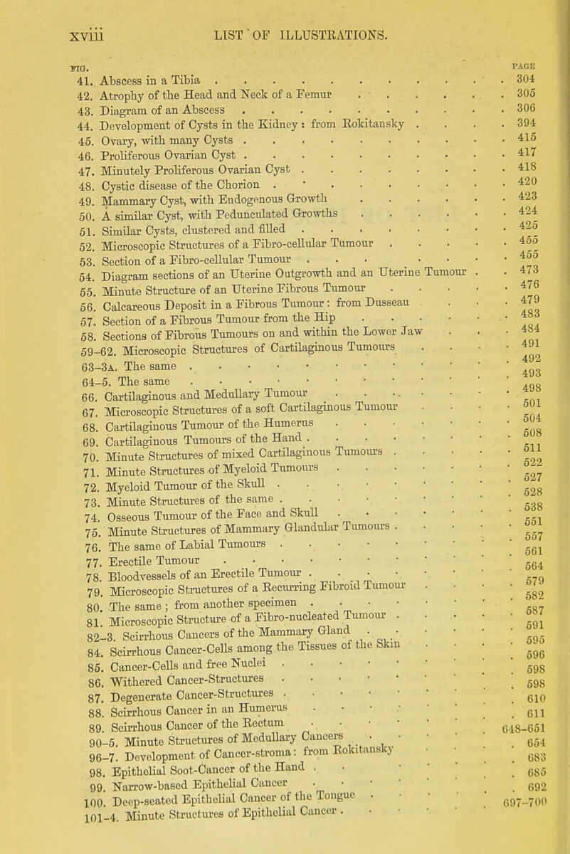 FIG. 41.. Abscess in a Tibia 42. Atropby of tbe Head and Neck of a Femur . ■ 43. Diagram of an Abscess 44. Development of Cysts in the Kidney : from Rokitansky 45. Ovary, with many Cysts 46. Proliferous Ovarian Cyst 47. Minutely Proliferous Ovarian Cyst .... 48. Cystic disease of the Chorion . * . . . 49. Mammary Cyst^ with Endogenous Growth 50. A similar Cyst, with Pedunculated Growths 51. Similar Cysts, clustered and fiUed .... 52. Microscopic Structures of a Fibro-eellular Tumour . 53. Section of a Fibro-cellular Tumour ... 54. Diagram sections of an Uterine Outgrowth and an Uterine 55. Minute Structure of an Uterine Fibrous Tumour 56. Calcareous Deposit in a Fibrous Tumour : from Dusseau 57. Section of a Fibrous Tumour from the Hip 58. Sections of Fibrous Tumours on and within the Lower Jaw 59-62. Microscopic Structures of Cartilaginous Tumours 63- 3A. The same 64- 5. The same 66. CartUaginous and Medullary Tumour 67. Microscopic Structui-es of a soft Cartilaginous Tumoui- 68. Cartilaginous Tumour of the Humerus 69. Cartilaginous Tumours of the Hand .... 70. Minute Structures of mixed CartUaginous Tumoiu-s . 71. Minute Structures of Myeloid Tumoiu-s . 72. Myeloid Tumour of the SkuU 73. Minute Structures of the same 74. Osseous Tumour of the Face and Skull 75'. Minute Structures of Mammary Glandular Tumours . 76. The same of Labial Tumours 77. Erectile Tumour 78 Bloodvessels of an Erectile Tumour . . . ■ 79. Microscopic Structures of a Eecurring Fibroid Tumoui- 80 The same ; from another specimen . . . • 81' Microscopic Structure of a Fibro-nucleated Tumour . 82-3 Scirrhous Cancers of the Mammary Gland . • 84. Scirrhous Cancer-Cells among the Tissues of the Slun 85. Cancer-CeUs and free Nuclei 86. Withered Cancer-Structures 87. Degenerate Cancer-Structures S8. Scirrhous Cancer in an Humerus . • • • 89 Scirrhous Cancer of the Rectum . • • • 90-5. Minute Structures of Medullaiy Cancers . • 96-7. Development of Cancer-stroma: from Rokitansky 98. Epithelial Soot-Cancer of the Hand . 99 Narrow-based Epithelial Cancer . • • • 100'. Deep-seated Epithelial Cancer of the Tongue . 101-4. Minute Structures of Epithelial Cancer . Tumour