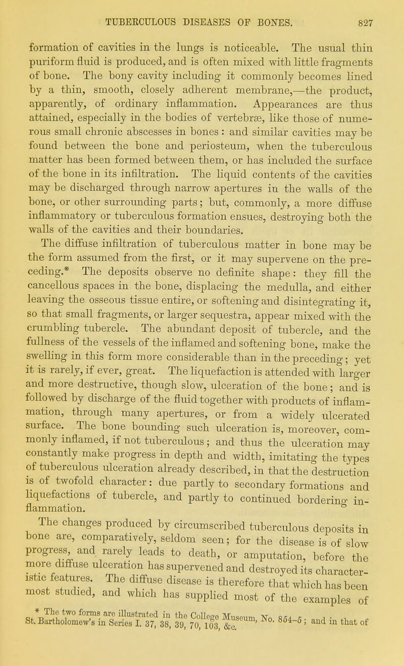 formation of cavities in the lungs is noticeable. The usual thin puriform fluid is produced, and is often mixed with little fragments of bone. The bony cavity including it commonly becomes lined by a thin, smooth, closely adherent membrane,—the product, apparently, of ordinary inflammation. Appearances are thus attained, especially in the bodies of vertebras, like those of nume- rous small chronic abscesses in bones: and similar cavities may be found between the bone and periosteum, when the tubercialous matter has been formed between them, or has included the surface of the bone in its infiltration. The liquid contents of the cavities may be discharged through narrow apertures in the walls of the bone, or other surrounding parts; but, commonly, a more diffuse inflammatory or tuberculous formation ensues, destroying both the walls of the cavities and their boundaries. The diffuse infiltration of tuberculous matter in bone may be the form assumed from the first, or it may supervene on the pre- ceding.* The deposits observe no definite shape: they fill the cancellous spaces in the bone, displacing the medulla, and either leaving the osseous tissue entire, or softening and disintegrating it, so that small fragments, or larger sequestra, appear mixed with the crumbbng tubercle. The abundant deposit of tubercle, and the fullness of the vessels of the inflamed and softening bone, make the swelling in this form more considerable than in the preceding; yet it is rarely, if ever, great. The liquefaction is attended with larger and more destructive, though slow, ulceration of the bone; and is followed by discharge of the fluid together with products of inflam- mation, through many apertures, or from a widely ulcerated surface. The bone bounding such ulceration is, moreover, com- monly inflamed, if not tuberculous; and thus the ulceration may constantly make progress in depth and width, imitating the types of tuberculous ulceration already described, in that the destruction is of twofold character: due partly to secondary formations and liquefactions of tubercle, and partly to continued borderino- in- flammation. ^ The changes produced by circumscribed tuberculous deposits in bone are, comparatively, seldom seen; for the disease is of slow progress and rarely leads to death, or amputation, before the more diffuse ulceration has supervened and destroyed its character- istic features The diffuse disease is therefore that which has been most studied, and which has supplied most of the examples of