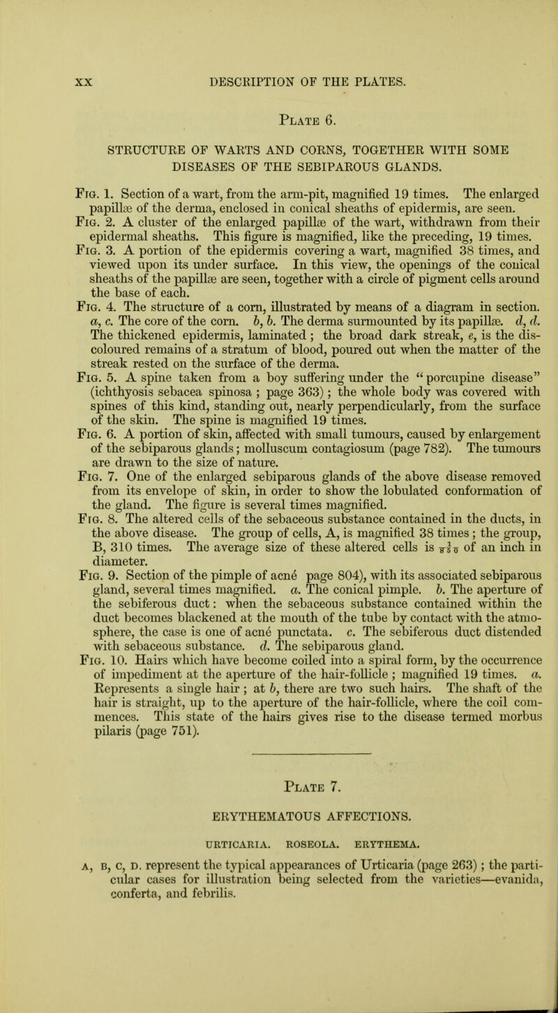 Plate 6. STRUCTURE OF WARTS AND CORNS, TOGETHER WITH SOME DISEASES OF THE SEBIPAROUS GLANDS. Fig. 1. Section of a wart, from the arm-pit, magnified 19 times. The enlarged papillae of the derma, enclosed in conical sheaths of epidermis, are seen. Fig. 2. A cluster of the enlarged papillae of the wart, withdrawn from their epidermal sheaths. This figure is magnified, like the preceding, 19 times. Fig. 3. A portion of the epidermis covering a wart, magnified 38 times, and viewed upon its under surface. In this view, the openings of the conical sheaths of the papillae are seen, together with a circle of pigment cells around the base of each. Fig. 4. The structure of a corn, illustrated by means of a diagram in section. a, c. The core of the corn, b, b. The derma surmounted by its papillae, d, d. The thickened epidermis, laminated ; the broad dark streak, e, is the dis- coloured remains of a stratum of blood, poured out when the matter of the streak rested on the surface of the derma. Fig. 5. A spine taken from a boy suffering under the  porcupine disease (ichthyosis sebacea spinosa ; page 363); the whole body was covered with spines of this kind, standing out, nearly perpendicularly, from the surface of the skin. The spine is magnified 19 times. Fig. 6. A portion of skin, affected with small tumours, caused by enlargement of the sebiparous glands; molluscum contagiosum (page 782). The tumours are drawn to the size of nature. Fig. 7. One of the enlarged sebiparous glands of the above disease removed from its envelope of skin, in order to show the lobulated conformation of the gland. The figure is several times magnified. Ftg. 8. The altered cells of the sebaceous substance contained in the ducts, in the above disease. The group of cells, A, is magnified 38 times; the group, B, 310 times. The average size of these altered cells is 7iU of an inch in diameter. Fig. 9. Section of the pimple of acne page 804), with its associated sebiparous gland, several times magnified, a. The conical pimple, b. The aperture of the sebiferous duct: when the sebaceous substance contained within the duct becomes blackened at the mouth of the tube by contact with the atmo- sphere, the case is one of acne punctata, c. The sebiferous duct distended with sebaceous substance, d. The sebiparous gland. Fig. 10. Hairs which have become coiled into a spiral form, by the occurrence of impediment at the aperture of the hair-follicle ; magnified 19 times, a. Represents a single hair ; at b, there are two such hairs. The shaft of the hair is straight, up to the aperture of the hair-follicle, where the coil com- mences. This state of the hairs gives rise to the disease termed morbus pilaris (page 751). Plate 7. ERYTHEMATOUS AFFECTIONS. URTICARIA. ROSEOLA. ERYTHEMA. a, b, c, d. represent the typical appearances of Urticaria (page 263); the parti- cular cases for illustration being selected from the varieties—evanida, conferta, and febrilis.