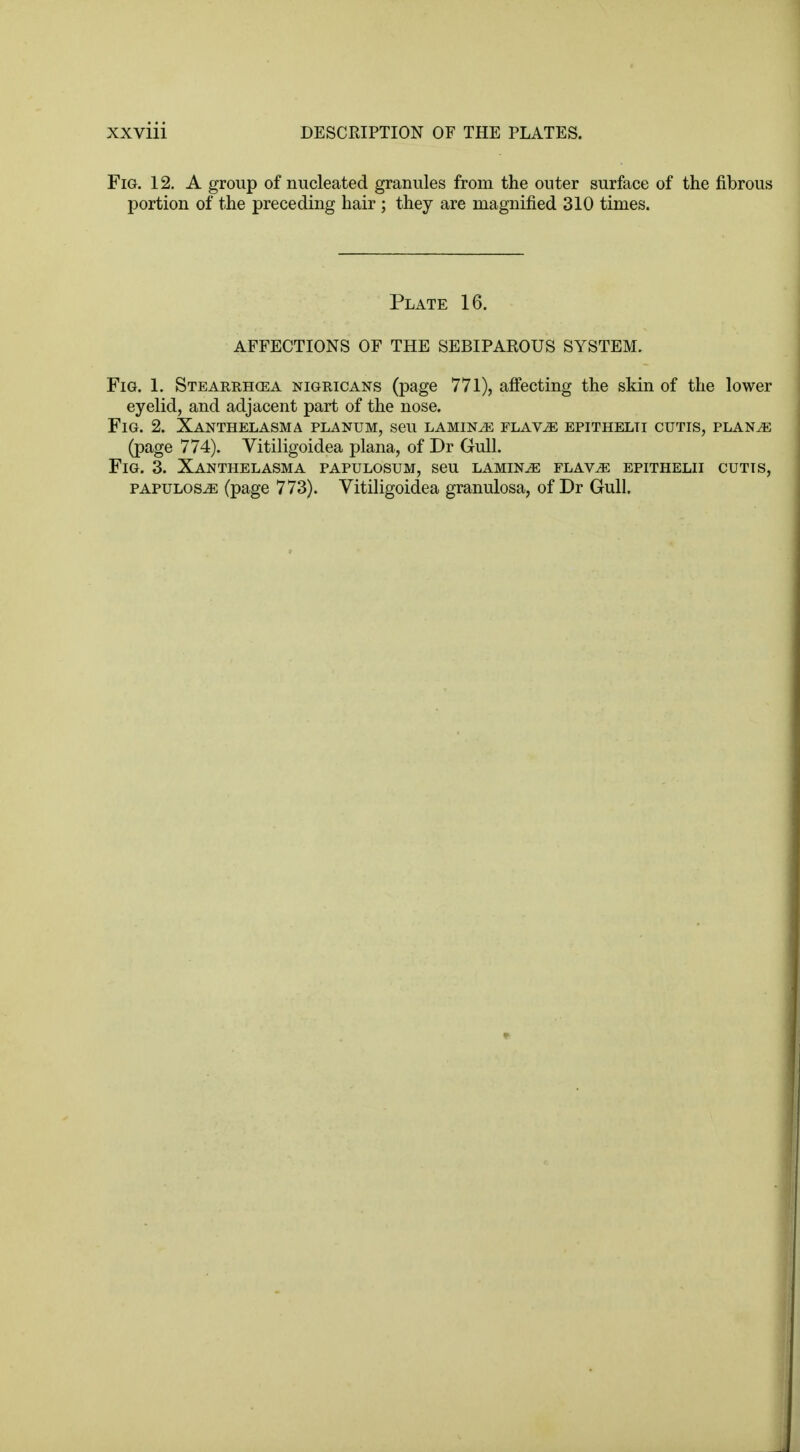 Fig. 12. A group of nucleated granules from the outer surface of the fibrous portion of the preceding hair ; they are magnified 310 times. Plate 16. AFFECTIONS OF THE SEBIPAROUS SYSTEM. Fig. 1. Stearrhcea nigricans (page 771), affecting the skin of the lower eyelid, and adjacent part of the nose. Fig. 2. Xanthelasma planum, seu laminae flavje epithelti cutis, plan^e (page 774). Vitiligoidea plana, of Dr Gull. Fig. 3. Xanthelasma papulosum, seu laminae flav^: epithelii cutis, papulosa (page 773). Vitiligoidea granulosa, of Dr Gull.