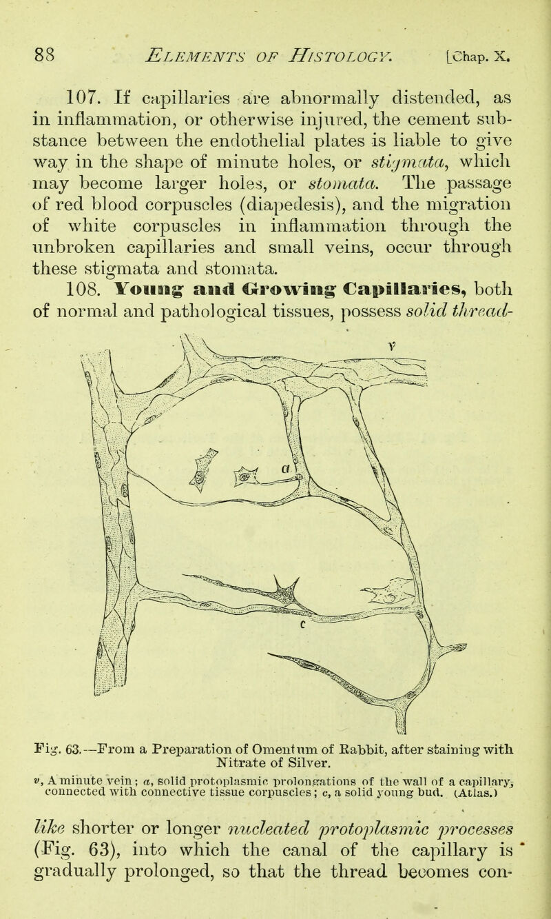 107. If capillaries are abnormally distended, as in inflammation, or otherwise injured, the cement sub- stance between the endothelial plates is liable to give way in the shape of minute holes, or stlpnaUi^ which may become larger holes, or stomata. The passage of red blood corpuscles (diapedesis), and the migration of white corpuscles in inflammation through the unbroken capillaries and small veins, occur through these stigmata and stomata. 108. Yoiiiig- and Orowins' Capillaries, both of normal and pathological tissues, possess solid tliread- Fig. 63.—From a Preparation of Omeutum of Eabbit, after staining with Nitrate of Silver. V, A minute vein; a, solid protoplasmic prolonsrations of tlaewall of a capillary-j connected with connective tissue corpuscles; c, a solid young bud. (Atlas.) like shorter or longer nucleated protojitlasmic jwocesses (Fig. 63), into which the canal of the capillary is gradually prolonged, so that the thread becomes con-