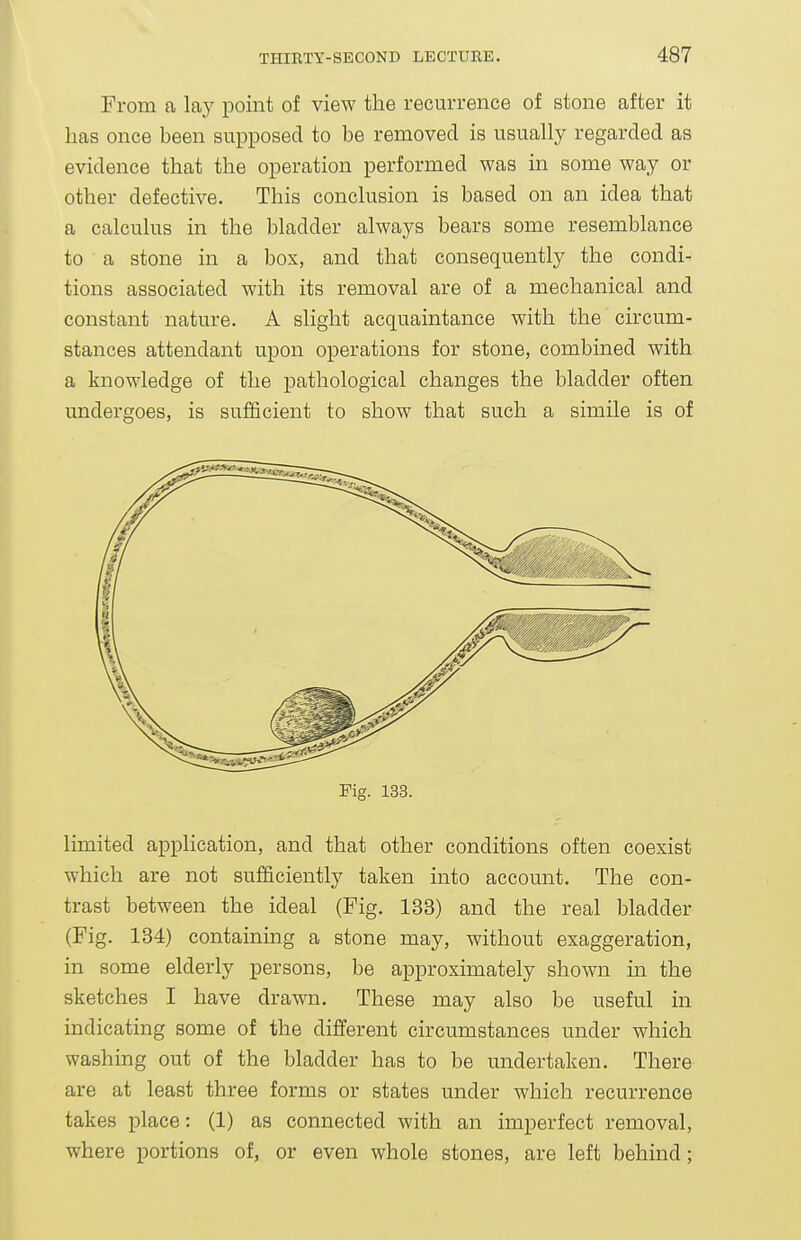 From a lay point of view the recurrence of stone after it has once been supposed to be removed is usually regarded as evidence that the operation performed was in some way or other defective. This conclusion is based on an idea that a calculus in the bladder always bears some resemblance to a stone in a box, and that consequently the condi- tions associated with its removal are of a mechanical and constant nature. A slight acquaintance with the circum- stances attendant upon operations for stone, combined with a knowledge of the pathological changes the bladder often undergoes, is sufficient to show that such a simile is of Pig. 133. limited application, and that other conditions often coexist which are not sufficiently taken into account. The con- trast between the ideal (Fig. 133) and the real bladder (Fig. 134) containing a stone may, without exaggeration, in some elderly persons, be approximately shown in the sketches I have drawn. These may also be useful in indicating some of the different circumstances under which washing out of the bladder has to be undertaken. There are at least three forms or states under which recurrence takes place: (1) as connected with an imperfect removal, where portions of, or even whole stones, are left behmd;