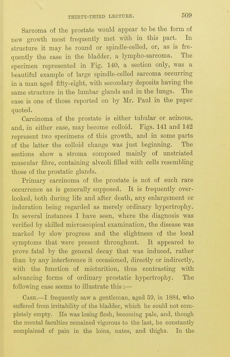 Sarcoma of the prostate would appear to be the form of new growth most frequently met with in this part. In structure it may be round or spindle-celled, or, as is fre- quently the case in the bladder, a lympho-sarcoma. The specimen represented in Fig. 140, a section only, was a beautiful example of large spindle-celled sarcoma occurring in a man aged fifty-eight, with secondary deposits having the same structure in the lumbar glands and in the lungs. The case is one of those reported on by Mr. Paul in the paper quoted. Carcinoma of the prostate is either tubular or acinous, and, in either case, may become colloid. Figs. 141 and 142 represent two specimens of this growth, and in some parts of the latter the colloid change was just beginning. The sections show a stroma composed mainly of unstriated muscular fibre, containing alveoli filled with cells resembling those of the prostatic glands. Primary carcinoma of the prostate is not of such rare occurrence as is generally supposed. It is frequently over- looked, both during life and after death, any enlargement or induration being regarded as merely ordinary hypertrophy. In several instances I have seen, where the diagnosis was verified by skilled microscopical examination, the disease was marked by slow progress and the slightness of the local symptoms that were present throughout. It appeared to prove fatal by the general decay that was induced, rather than by any interference it occasioned, directly or indirectly, with the function of micturition, thus contrasting with advancing forms of ordinary prostatic hypertrophy. The following case seems to illustrate this:— Case.—I frequently saw a gentleman, aged 59, in 1884, who suffered from irritability of the bladder, which he could not com- pletely empty. He was losing flesh, becoming pale, and, though the mental faculties remained vigorous to the last, he constantly complained of pain in the loins, nates, and thighs. In the