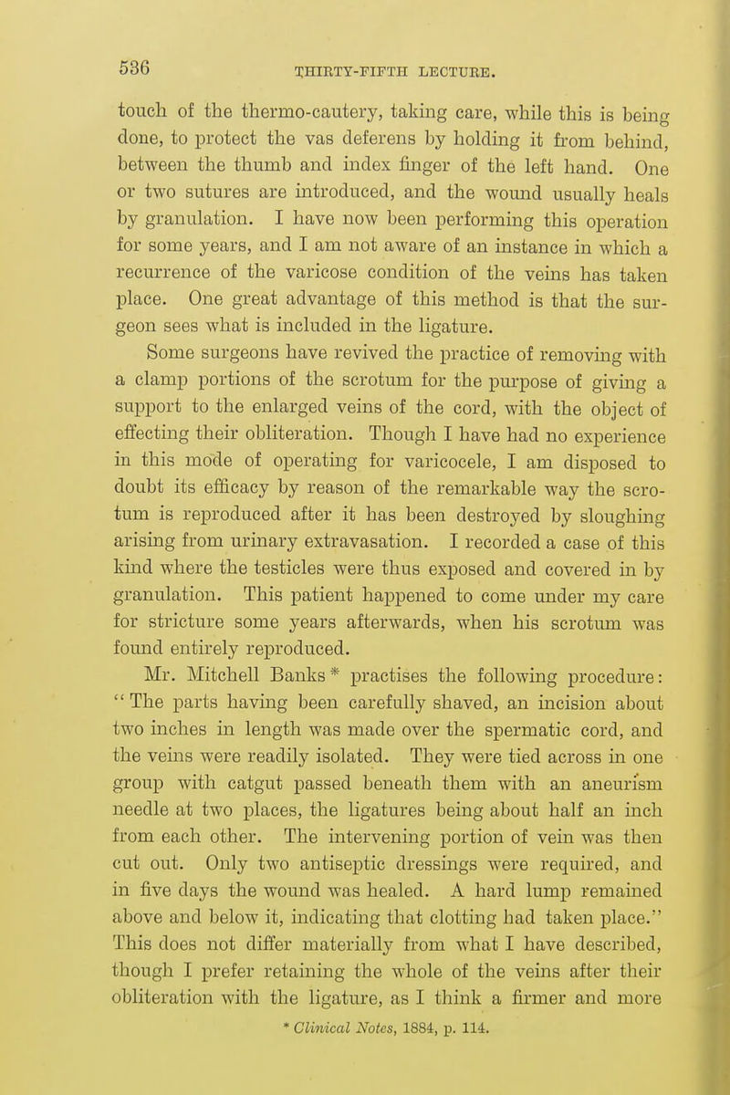 touch of the thermo-cautery, taking care, while this is being done, to protect the vas deferens by holding it from behind, between the thumb and index finger of the left hand. One or two sutures are introduced, and the wound usually heals by granulation. I have now been performing this operation for some years, and I am not aware of an instance in which a recurrence of the varicose condition of the veins has taken place. One great advantage of this method is that the sur- geon sees what is included in the ligature. Some surgeons have revived the practice of removmg with a clamp portions of the scrotum for the purpose of giving a support to the enlarged veins of the cord, with the object of effecting their obliteration. Though I have had no experience in this mode of operating for varicocele, I am disposed to doubt its efficacy by reason of the remarkable way the scro- tum is reproduced after it has been destroyed by sloughing arising from urinary extravasation. I recorded a case of this kmd where the testicles were thus exposed and covered in by granulation. This patient happened to come under my care for stricture some years afterwards, when his scrotum was found entirely reproduced. Mr. Mitchell Banks* practises the following procedure:  The parts having been carefully shaved, an incision about two inches in length was made over the spermatic cord, and the veins were readily isolated. They were tied across in one group with catgut passed beneath them with an aneurism needle at two places, the ligatures being about half an inch from each other. The intervening j)ortion of vein was then cut out. Only two antiseptic dressings were required, and in five days the wound was healed. A hard lump remained above and below it, indicating that clotting had taken place. This does not differ materially from what I have described, though I prefer retaining the whole of the veins after their obliteration with the ligature, as I think a firmer and more * Clinical Notes, 1884, p. 114.