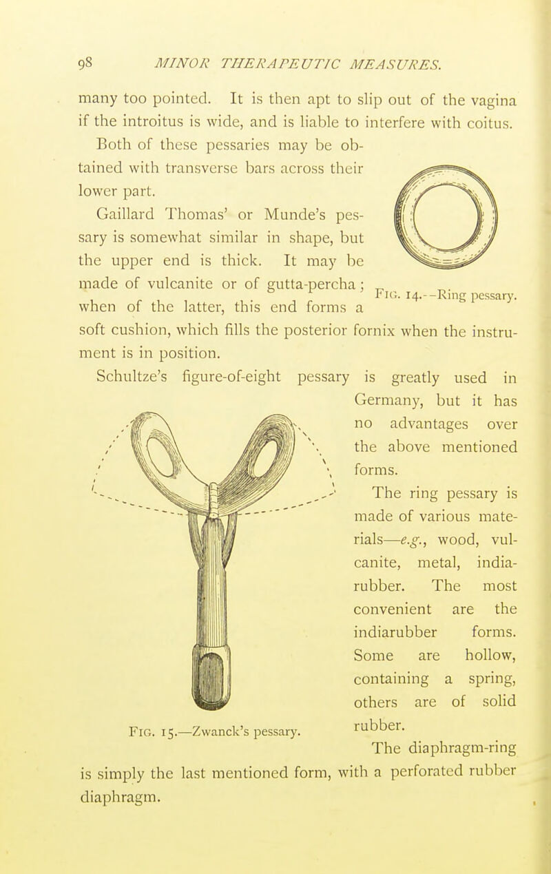 Fir,. 14.--Ring pessary. many too pointed. It is then apt to slip out of the vagina if the introitus is wide, and is liable to interfere with coitus. Both of these pessaries may be ob- tained with transverse bars across their lower part. Gaillard Thomas' or Munde's pes- sary is somewhat similar in shape, but the upper end is thick. It may be made of vulcanite or of gutta-percha; when of the latter, this end forms a soft cushion, which fills the posterior fornix when the instru- ment is in position. Schultze's figure-of-eight pessary is greatly used in Germany, but it has no advantages over the above mentioned forms. The ring pessary is made of various mate- rials—e.g., wood, vul- canite, metal, india- rubber. The most convenient are the indiarubber forms. Some are hollow, containing a spring, others are of solid rubber. The diaphragm-ring is simply the last mentioned form, with a perforated rubber diaphragm. Fig. 15.—Zwanck's pessary.
