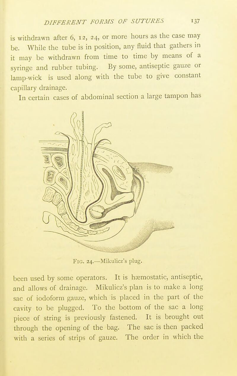 is withdrawn after 6, 12, 24, or more hours as the case may be. While the tube is in position, any fluid that gathers in it may be withdrawn from time to time by means of a syringe and rubber tubing. By some, antiseptic gauze or lamp-wick is used along with the tube to give constant capillary drainage. In certain cases of abdominal section a large tampon has Fig. 24.—Mikulicz's plug. been used by some operators. It is haemostatic, antiseptic, and allows of drainage. Mikulicz's plan is to make a long sac of iodoform gauze, which is placed in the part of the cavity to be plugged. To the bottom of the sac a long piece of string is previously fastened. It is brought out through the opening of the bag. The sac is then packed with a series of strips of gauze. The order in which the