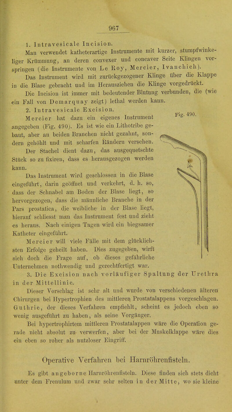 1. lutravesicale Incision. Man verwendet katheterartige Instrumente mit kurzer, stumpfwinke- liger Krümmung, an deren convexer und concaver Seite Küngen vor- springen (die Instrumente von Le Roy, Mercier, Ivancliich). Das Instrument wird mit zurückgezogener Klinge über die Klappe in die Blase gebracht und im Herausziehen die Klinge vorgedrückt. Die Incision ist immer mit bedeutender Blutung verbunden, die (wie ein Fall von Demarquay zeigt) lethal werden kann. 2. Intravesicale Excision. Mercier hat dazu ein eigenes Instrument angegeben (Fig. 490j. Es ist wie ein Lithotribe ge- baut, aber an beiden Branchen nicht gezahnt, son- dern gehöhlt und mit scharfen Rändern versehen. Der Stachel dient dazu, das ausgequetschte Stück so zu fisiren, dass es herausgezogen werden kann. Das Instrument wird geschlossen in die Blase eingeführt, darin geöffnet und verkehrt, d. h. so, dass der Schnabel am Boden der Blase liegt, so hervorgezogen, dass die männUche Branche in der Pars prostatica, die weibliche in der Blase liegt, hierauf scliUesst man das Instrument fest und zieht es heraus. Nach einigen Tagen wird ein biegsamer Katheter eingeführt. Mercier will viele Fälle mit dem glücklich- sten Erfolge geheilt haben. Dies zugegeben, wirft sich doch die Frage auf, ob dieses gefährliche Unternehmen nothwendig und gerechtfertigt war. 3. Die Excision nach vorläufiger Spaltung der Urethra in der Mittellinie. Dieser Vorschlag ist sehr alt und wurde von verschiedenen älteren Chirurgen bei Hypertrophien des mittleren Prostatalappens vorgeschlagen. Guthrie, der dieses Verfahren empfiehlt, scheint es jedoch eben so wenig ausgeführt zu haben, als seine Vorgänger. Bei liypertrophirtem mittleren Prostatalappen wäre die Operation ge- rade nicht absolut zu- verwerfen, aber bei der Muskelklappe wäre dies ein eben so roher als nutzloser Eingriff. Operative Verfahren bei Harnrölirenfistelii. Es gibt angeborne Harnröhrenfisteln. Diese finden sich stets dicht unter dem Frenulum und zwar sehr selten in der Mitte, wo sie kleine