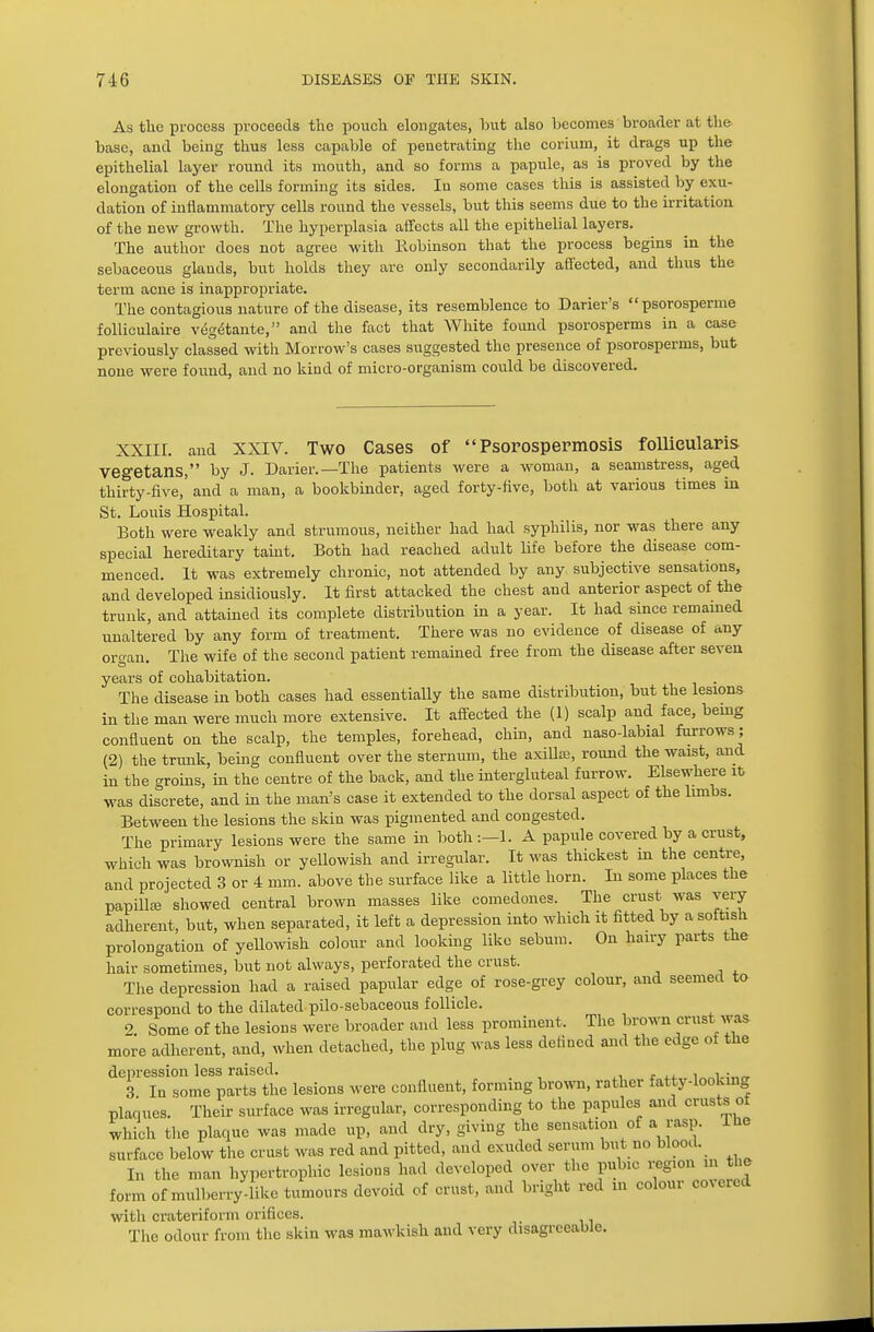 As the process proceeds the pouch elongates, but also becomes broader at the base, and being thus less capable of penetrating the corium, it drags up the epithelial layer round its mouth, and so forms a papule, as is proved by the elongation of the cells forming its sides. In some cases this is assisted by exu- dation of inflammatory cells round the vessels, but this seems due to the irritation of the new growth. The hyperplasia affects all the epithelial layers. The author does not agree with Robinson that the process begins in the sebaceous glands, but holds they are only secondarily affected, and thus the term acne is inappropriate. The contagious nature of the disease, its resemblence to Darier's psorosperme folliculaire vegetante, and the fact that White found psorosperms in a case previously classed with Morrow's cases suggested the presence of psorosperms, but none were found, and no kind of micro-organism could be discovered. XXIII. and XXIV. Two Cases of Psorospermosis follieularis vegetans, by J. Darier.— The patients were a woman, a seamstress, aged thirty-five,' and a man, a bookbinder, aged forty-five, both at various times in St. Louis Hospital. Both were weakly and strumous, neither had had syphilis, nor was there any special hereditary taint. Both had reached adult life before the disease com- menced. It was extremely chronic, not attended by any subjective sensations, and developed insidiously. It first attacked the chest and anterior aspect of the trunk, and attained its complete distribution in a year. It had since remained unaltered by any form of treatment. There was no evidence of disease of any organ. The wife of the second patient remained free from the disease after seven years of cohabitation. The disease in both cases had essentially the same distribution, but the lesions in the man were much more extensive. It affected the (1) scalp and face, bemg confluent on the scalp, the temples, forehead, chin, and naso-labial furrows ; (2) the trunk, being confluent over the sternum, the axilla:, round the waist, and in the groins, in the centre of the back, and the intergluteal furrow. Elsewhere it was discrete, and in the man's case it extended to the dorsal aspect of the limbs. Between the lesions the skin was pigmented and congested. The primary lesions were the same in both :—1. A papule covered by a crust, which was brownish or yellowish and irregular. It was thickest in the centre, and projected 3 or 4 mm. above the surface like a little horn. In some places the papillfe showed central brown masses like comedones. The crust was very adherent, but, when separated, it left a depression into which it fitted by a softish prolongation of yellowish colour and looking like sebum. On hairy parts tne hair sometimes, but not always, perforated the crust. The depression had a raised papular edge of rose-grey colour, and seemed to correspond to the dilated pilo-sebaceous follicle. 2 Some of the lesions were broader and less prominent. The brown crust was more adherent, and, when detached, the plug was less delincd and the edge of the depression less raised. i„„i,5„«. 3 In some parts the lesions were confluent, forming brown, rather fatty-looking plaques. Their surface was irregular, corresponding to the papules and crusts of which the plaque was made up, and dry, giving the sensation of a rasp, the surface below the crust was red and pitted, and exuded serum but no blood. In the man hypertrophic lesions had developed over the pubic reg.on in the form of mulberry like tumours devoid of crust, and bright red in colour covered with crateriform orifices. The odour from the skin was mawkish and very disagreeable.