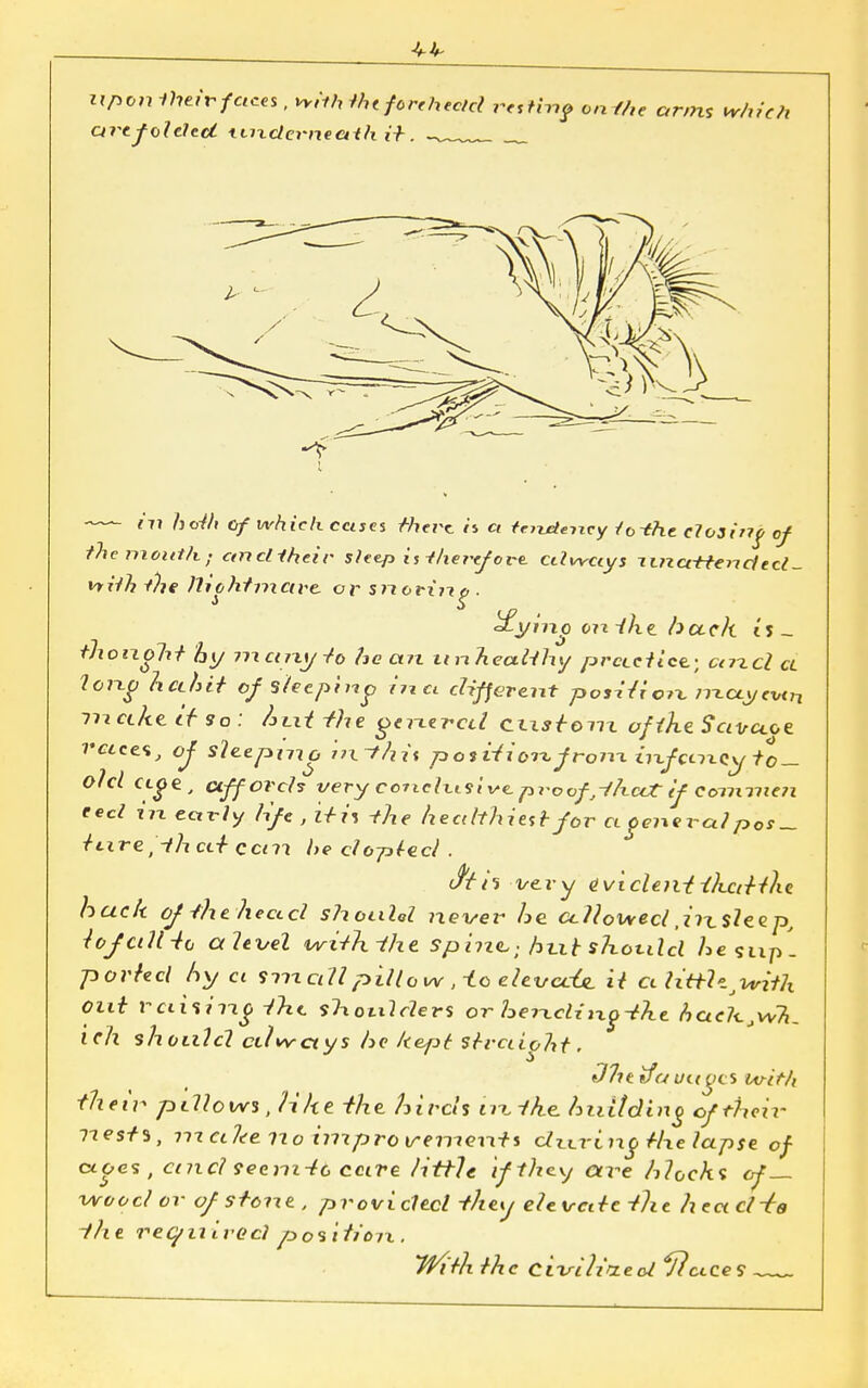 ^ upon their f aces, whhthtforehecld resting onihe arms whictt art folded underneath it . in both of which cajcs Merc is a tendency 10-Chc closing of the mouth > ancliheir sleep it-therefore, cdwccys un attendecl- vtHh the )li6hfmetre, or snorin o . ^ytno on the. beech is ~ thoixoht hy many-to he an unhealthy practice.- enxel a long hcthit of sleeping hi a different position ?nciyevtn make, if so: /jutJ -the geuercd cixstem of the. Savaoe. races, oj sleeping m~thi% p os ition from infemcytp— old Cige,, affords very conclusive, proof ,-thaT if Commen ted in. eoWy life , it-it -the healthiest for a general pos^ itxre^-thcLT car\ he d opted . n very evident ilixtithe hack of -the head shouUl never he ct-llowecl jn.sleep, lojcillto ctlevel with the. Sphzc; hut shotdcl he supl ported hy ci sm all pill o w ,i.o elevccU. it ct ?tft?e,*nVA out railing the shoulders or heucliixg-the hacK.Wh, ich should edwetys he kept straight. t/7itvavetoes tvit/i theiv pillows, like the hirds n^ike, hidtding cftheii- 7Tes/3, 777 a he ii o tnip ro vemeixti during the lapse of ages , ct?icl seem-to care little if-they are hlochs of— wood or of stone , provided -they elevate the hea d^g the re (y li t rod posihojx. With the