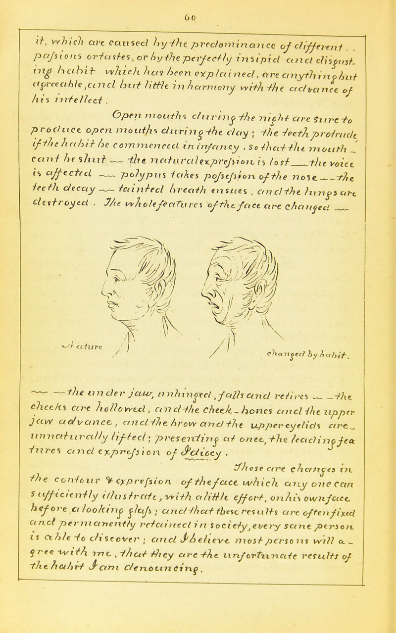 if, which are caused hy-the. predominance of clifferent pafsions oriasles,or hytheperfeelly inu'picl ct?icl disgust, trig habit which hat keen explained, are anythino/mt cipreeaMC)cind lout little hiharmony wifh-tht advance of his intellect . Open mouths during -the riicM arc Sure+o produce open mouths durino-the day ; the -feethproiruclt ifiJiehahir t>e commenced in infancy , So that-tin mouth 1 cant he shut — -flut natural ex.pr ofii on. is lost the voice i% affected -— polypus takes pofstfuonofthe no%e.^-?7,e teeth decay _~ tainted hreath ensues , ancHhe Jungs art destroyed . J/tc whole features of the face are chanced ~ -the under jour, tinhinoed, faffs and retires -fhe checks cere hollowed, ctrtcH/te chtek-hones ancliht upper jaw advance, ancLththrow andthe upper eyelids are., unnaturally lifted- presenting at oneetthe teadinofea. -ttircs coid ejLp-refiiorx. of <^dioey . Jh ese are changes in. the contour * eyprefsion of theface which anyojtecctn Sufficiently i/lus Irate, with a/title effort, cihis ownface. hef ore a looking fhefs; andihat these res ti its arcoftenfixtel a nd perm an entry retained in society ^very sane person, is Cth/e-to discover } and </Relieve most persons will a. - free -with -me. .that tJiey are the unfortizncde retails of thehahit J1 am c/enot-mCinq .
