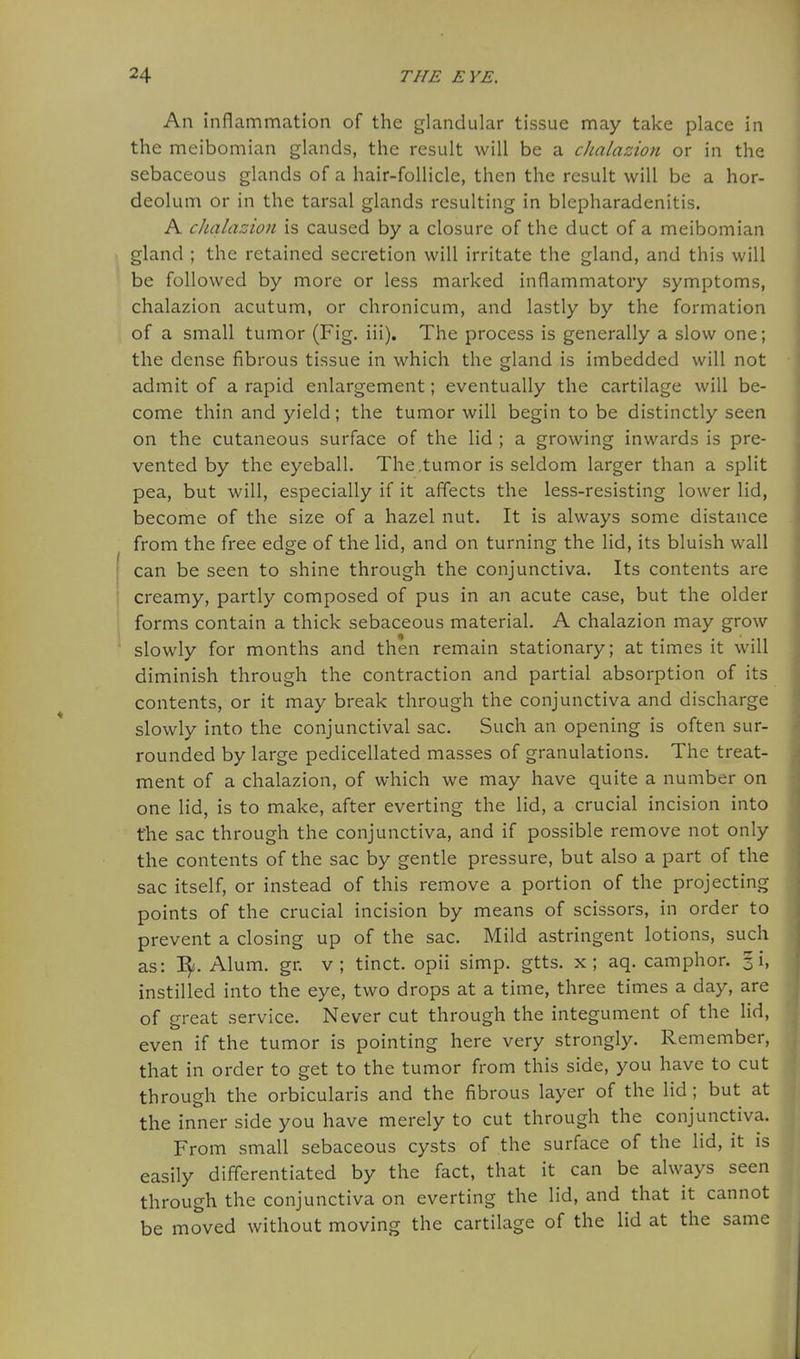 An inflammation of the glandular tissue may take place in the meibomian glands, the result will be a cJuilazion or in the sebaceous glands of a hair-follicle, then the result will be a hor- deolum or in the tarsal glands resulting in blcpharadenitis. A chalazion is caused by a closure of the duct of a meibomian gland ; the retained secretion will irritate the gland, and this will be followed by more or less marked inflammatory symptoms, chalazion acutum, or chronicum, and lastly by the formation of a small tumor (Fig. iii). The process is generally a slow one; the dense fibrous tissue in which the gland is imbedded will not admit of a rapid enlargement; eventually the cartilage will be- come thin and yield; the tumor will begin to be distinctly seen on the cutaneous surface of the lid ; a growing inwards is pre- vented by the eyeball. The.tumor is seldom larger than a split pea, but will, especially if it affects the less-resisting lower lid, become of the size of a hazel nut. It is always some distance from the free edge of the lid, and on turning the lid, its bluish wall can be seen to shine through the conjunctiva. Its contents are creamy, partly composed of pus in an acute case, but the older forms contain a thick sebaceous material. A chalazion may grow slowly for months and then remain stationary; at times it will diminish through the contraction and partial absorption of its contents, or it may break through the conjunctiva and discharge slowly into the conjunctival sac. Such an opening is often sur- rounded by large pedicellated masses of granulations. The treat- ment of a chalazion, of which we may have quite a number on one lid, is to make, after everting the lid, a crucial incision into the sac through the conjunctiva, and if possible remove not only the contents of the sac by gentle pressure, but also a part of the sac itself, or instead of this remove a portion of the projecting points of the crucial incision by means of scissors, in order to prevent a closing up of the sac. Mild astringent lotions, such as: I^. Alum. gr. v; tinct. opii simp. gtts. x; aq. camphor. 31, instilled into the eye, two drops at a time, three times a day, are of great service. Never cut through the integument of the lid, even if the tumor is pointing here very strongly. Remember, that in order to get to the tumor from this side, you have to cut through the orbicularis and the fibrous layer of the lid; but at the inner side you have merely to cut through the conjunctiva. From small sebaceous cysts of the surface of the lid, it is easily differentiated by the fact, that it can be always seen through the conjunctiva on everting the lid, and that it cannot be moved without moving the cartilage of the lid at the same