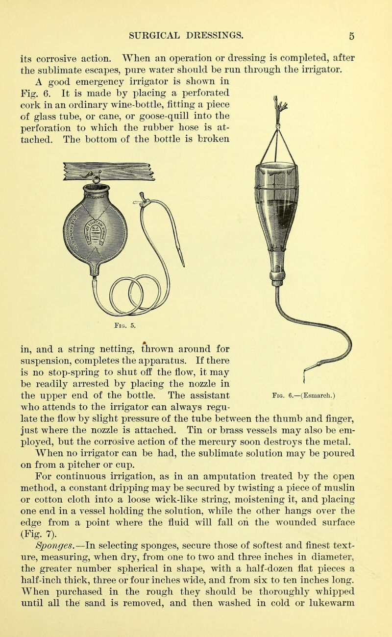 its corrosive action. When an operation or dressing is completed, after the sublimate escapes, pure water should be run through the irrigator. A good emergency irrigator is shown in Fig. 6. It is made by placing a perforated cork in an ordinary wine-bottle, fitting a piece of glass tube, or cane, or goose-quill into the perforation to which the rubber hose is at- tached. The bottom of the bottle is broken Fig. 6.—(Esmarch.) Fig. 5. in, and a string netting, thrown around for suspension, completes the apparatus. If there is no stop-spring to shut off the flow, it may be readily arrested by placing the nozzle in the upper end of the bottle. The assistant who attends to the irrigator can always regu- late the flow by slight pressure of the tube between the thumb and finger, just where the nozzle is attached. Tin or brass vessels may also be em- ployed, but the corrosive action of the mercury soon destroys the metal. When no irrigator can be had, the sublimate solution may be poured on from a pitcher or cup. For continuous irrigation, as in an amputation treated by the open method, a constant dripping may be secured by twisting a piece of muslin or cotton cloth into a loose wick-like string, moistening it, and placing one end in a vessel holding the solution, while the other hangs over the edge from a point where the fluid will fall on the wounded surface (Fig. 7). Sponges.—In selecting sponges, secure those of softest and finest text- ure, measuring, when dry, from one to two and three inches in diameter, the greater number spherical in shape, with a half-dozen flat pieces a half-inch thick, three or four inches wide, and from six to ten inches long. When purchased in the rough they should be thoroughly whipped until all the sand is removed, and then washed in cold or lukewarm