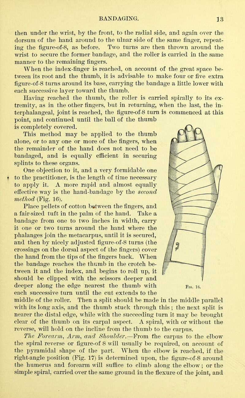 then under the wrist, by the front, to the radial side, and again over the dorsum of the hand around to the ulnar side of the same finger, repeat- ing the figure-of-8, as before. Two turns are then thrown around the wrist to secure the former bandage, and the roller is carried in the same manner to the remaining fingers. When the index-finger is reached, on account of the great space be- tween its root and the thumb, it is advisable to make four or five extra figure-of-8 turns around its base, carrying the bandage a little lower with each successive layer toward the thumb. Having reached the thumb, the roller is carried spirally to its ex- tremity, as in the other fingers, but in returning, when the last, the in- terphalangeal, Joint is reached, the figure-of-8 turn is commenced at this point, and continued until the ball of the thumb is completely covered. This method may be applied to the thumb alone, or to any one or more of the fingers, when the remainder of the hand does not need to be bandaged, and is equally efficient in securing splints to these organs. One objection to it, and a very formidable one t to the practitioner, is the length of time necessary to apply it. A more rapid and almost equally effective way is the hand-bandage by the second metJiod (Fig. 16). Place pellets of cotton batween the fingers, and a fair-sized tuft in the palm of the hand. Take a bandage from one to two inches in width, carry it one or two turns around the hand where the phalanges join the metacarpus, until it is secured, and then by nicely adjusted figiire-of-8 turns (the crossings on the dorsal aspect of the fingers) cover the hand from the tips of the fingers back. When the bandage reaches the thumb in the crotch be- tween it and the index, and begins to roll up, it should be clipped with the scissors deeper and each successive turn until the cut extends to the middle of the roller. Then a split should be made in the middle parallel with its long axis, and the thumb stuck through this ; the next split is nearer the distal edge, while with the succeeding turn it may be brought clear of the thumb on its carpal aspect. A spiral, with or without the reverse, will hold on the incline from the thumb to the carpus. The Forearm, Arm, and Shoulder.—From the carpus to the elbow the spiral reverse or figure-of 8 will usually be required, on account of the pyramidal shape of the part. When the elbow is reached, if the right-angle position (Fig. 17) is determined upon, the figure-of-8 around the humerus and forearm will suffice to climb along the elbow; or the simple spiral, carried over the same ground in the flexure of the joint, and