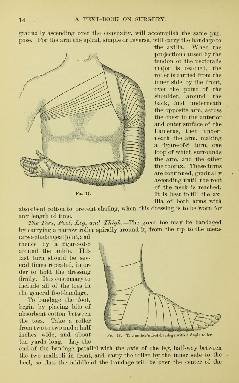 Fig. 17. gradually ascending over the convexity, will accomplisli the same pur- pose. For the arm the spiral, simple or reverse, will carry the bandage to the axilla. When the projection caused by the tendon of the pectoralis major is reached, the roller is carried from the inner side by the front, over the point of the shoulder, around the back, and underneath the opposite arm, across the chest to the anterior and outer surface of the humerus, then under- neath the arm, making a figure-of-8 turn, one loop of which surrounds the arm, and the other the thorax. These turns are continued, gradually ascending until the root of the neck is reached. It is best to fill the ax- illa of both arms with absorbent cotton to prevent chafing, when this dressing is to be worn for any length of time. Tlie Toes, Foot, Leg, and TMgh.—T^^ great toe may be bandaged by carrying a narrow roller spirally around it, from the tip to the meta- tarso-phalangeal joint, and thence by a figure-of-8 around the ankle. This last turn should be sev- eral times repeated, in or- der to hold the dressing firmly. It is customary to include all of the toes in the general foot-bandage. To bandage the foot, begin by placing bits of absorbent cotton between the toes. Take a roller from two to two and a half inches wide, and about ten yards long. Lay the end of the bandage parallel with the axis of the leg, half-way between the two malleoli in front, and carry the roller by the inner side to the heel, so that the middle of the bandage wiU be over the center of the Fig. 18.—Tlic author's foot-bandaL'e with a .single roller. I