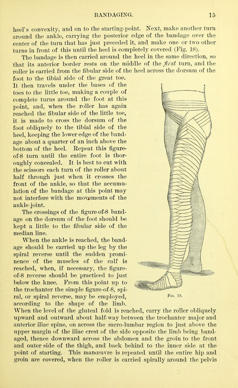 heers convexity, and on to the starting-point. Next, make another turn around the ankle, carrying the posterior edge of the bandage over the center of the turn that has just preceded it, and make one or two other turns in front of this until the heel is completely covered (Fig. 18). The bandage is then carried around the heel in the same direction, so that its anterior border rests on the middle of the first turn, and the roller is carried from the fibular side of the heel across the dorsum of the foot to the tibial side of the great toe. It then travels under the bases of the toes to the little toe, making a couple of complete turns around the foot at this point, and, vs^hen the roller has again reached the fibular side of the little toe, it is made to cross the dorsum of the foot obliquely to the tibial side of the heel, keeping the lower edge of the band- age about a quarter of an inch above the bottom of the heel. Repeat this figure- of-8 turn until the entire foot is thor- oughly concealed. It is best to cut wdth the scissors each turn of the roller about half through just when it crosses the front of the ankle, so that the accumu- lation of the bandage at this point may not interfere with the movements of the ankle-joint. The crossings of the figure-of-8 band- age on the dorsum of the foot should be kept a little to the fibular side of the median line. When the ankle is reached, the band- age should be carried up the leg by the spiral reverse until the sudden promi- nence of the muscles of the calf is reached, when, if necessary, the figure- of-8 reverse should be practiced to just below the knee. From this point up to the trochanter the simple figure-of-8, spi- ral, or spiral reverse, may be employed, according to the shape of the limb. When the level of the gluteal fold is reached, carry the roller obliquely upward and outward about half-way between the trochanter major and anterior iliac spine, on across the sacro-lumbar region to just above the upper margin of the iliac crest of the side opposite the limb being band- aged, thence downward across the abdomen and the groin to the front and outer side of the thigh, and back behind to the inner side at the point of starting. This manoeuvre is repeated until the entire hip and groin are covered, when the roller is carried spirally around the pelvis