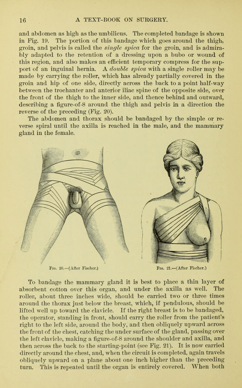 and abdomen as higli as the umbilicus. The completed bandage is shown in Fig. 19. The portion of this bandage which goes around the thigh, groin, and pelvis is called the single spica for the groin, and is admira- bly adapted to the retention of a dressing upon a bubo or wound of this region, and also makes an efficient temporary compress for the sup- port of an inguinal hernia. A double spica with a single roller may be made by carrying the roller, which has already partially covered in the groin and hip of one side, directly across the back to a point half-way between the trochanter and anterior iliac spine of the opposite side, over the front of the thigh to the inner side, and thence behind and outward, describing a figure-of-8 around the thigh and pelvis in a direction the reverse of the preceding (Fig. 20). The abdomen and thorax should be bandaged by the simple or re- verse spiral until the axilla is reached in the male, and the mammary gland in the female. Fig. 20.—(After Fiscbcr.) Fig. 21.—(After Fischer.) To bandage the mammary gland it is best to place a thin layer of absorbent cotton over this organ, and under the axilla as well. The roller, about three inches wide, should be carried two or three times around the thorax just below the breast, which, if pendulous, should be lifted well up toward the clavicle. If the right breast is to be bandaged, the operator, standing in front, should carry the roller from the patient's right to the left side, around the body, and then obliquely upward across the front of the chest, catching the under surface of the gland, passing over the left clavicle, making a figure-of-8 around the shoulder and axilla, and then across the back to the starting-point (see Fig. 21). It is now carried directly around the chest, and, when the circuit is completed, again travels obliquely upward on a plane about one inch higher than the preceding turn. This is repeated until the organ is entirely covered. When both