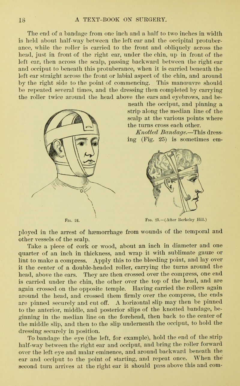 The end of a bandage from one inch and a half to two inches in width is held about half-way between the left ear and the occipital protuber- ance, while the roller is carried to the front and obliquely across the head, just in front of the right ear, under the chin, up in front of the left ear, then across the scalp, passing backward between the right ear and occiput to beneath this protuberance, when it is carried beneath the left ear straight across the front or labial aspect of the chin, and around by the right side to the point of commencing. This manoeuvre should be repeated several times, and the dressing then completed by carrying the roller twice around the head above the ears and eyebrows, and be- neath the occiput, and pinning a Fig. 24. Fig. 25.—(After Berkeley Hill.) ployed in the arrest of haemorrhage from wounds of the temporal and other vessels of the scalp. Take a piece of cork or wood, about an inch in diameter and one quarter of an inch in thickness, and wrap it with sublimate gauze or lint to make a compress. Apply this to the bleeding point, and lay over it the center of a double-headed roller, carrying the turns around the head, above the ears. They are then crossed over the compress, one end is carried under the chin, the other over the top of the head, and are again crossed on the opposite temple. Having carried the rollers again around the head, and crossed them firmly over the compress, the ends are pinned securely and cut off. A horizontal slip may then be pinned to the anterior, middle, and posterior slips of the knotted bandage, be- ginning in the median line on the forehead, then back to the center of the middle slip, and then to the slip underneath the occiput, to hold the dressing securely in position. To bandage the eye (the left, for example), hold the end of the strip half-way between the right ear and occiput, and bring the roller forward over the left eye and malar eminence, and around backward beneath the ear and occiput to the point of starting, and repeat once. When the second turn arrives at the right ear it should pass above this and com-