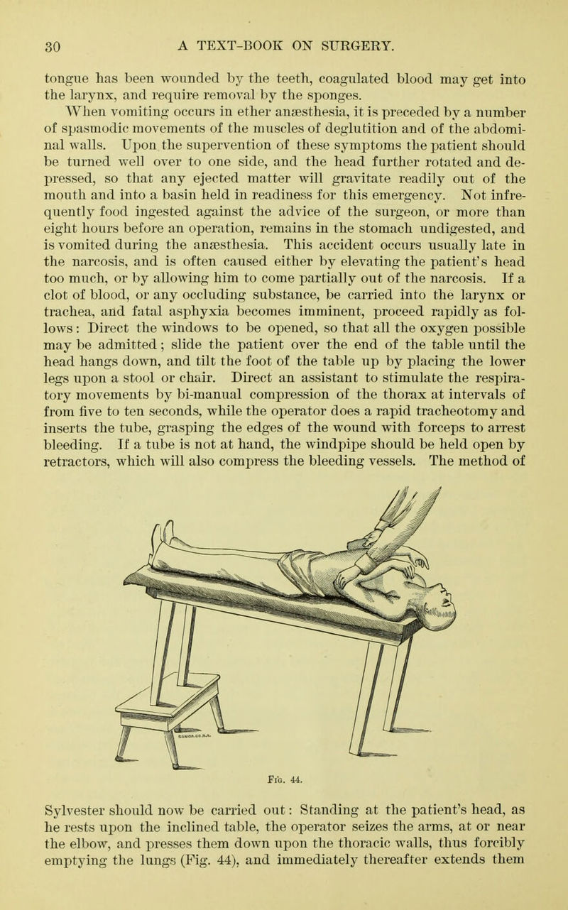 tongue has been wounded by tlie teeth, coagulated blood may get into the larynx, and require removal by the sjionges. When vomiting occurs in ether anaesthesia, it is preceded by a number of spasmodic movements of the muscles of deglutition and of the abdomi- nal walls. Upon the supervention of these symptoms the patient should be turned well over to one side, and the head further rotated and de- pressed, so that any ejected matter will gravitate readily out of the mouth and into a basin held in readiness for this emergency. Not infre- quently food ingested against the advice of the surgeon, or more than eight hours before an operation, remains in the stomach undigested, and is vomited during the anaesthesia. This accident occurs usually late in the narcosis, and is often caused either by elevating the patient's head too much, or by allowing him to come partially out of the narcosis. If a clot of blood, or any occluding substance, be carried into the larynx or trachea, and fatal asphyxia becomes imminent, proceed rapidly as fol- lows : Direct the windows to be opened, so that all the oxygen possible may be admitted; slide the patient over the end of the table until the head hangs down, and tilt the foot of the table up by placing the lower legs upon a stool or chair. Direct an assistant to stimulate the respira- tory movements by bi-manual compression of the thorax at intervals of from five to ten seconds, while the operator does a rapid tracheotomy and inserts the tube, grasping the edges of the wound with forceps to arrest bleeding. If a tube is not at hand, the windpipe should be held open by retractors, which will also compress the bleeding vessels. The method of Fig. 44. Sylvester should now be carried out: Standing at the patient's head, as he rests upon the inclined table, the operator seizes the arms, at or near the elbow, and presses them down upon the thoracic walls, thus forcibly emptying the lungs (Fig. 44), and immediately thereafter extends them