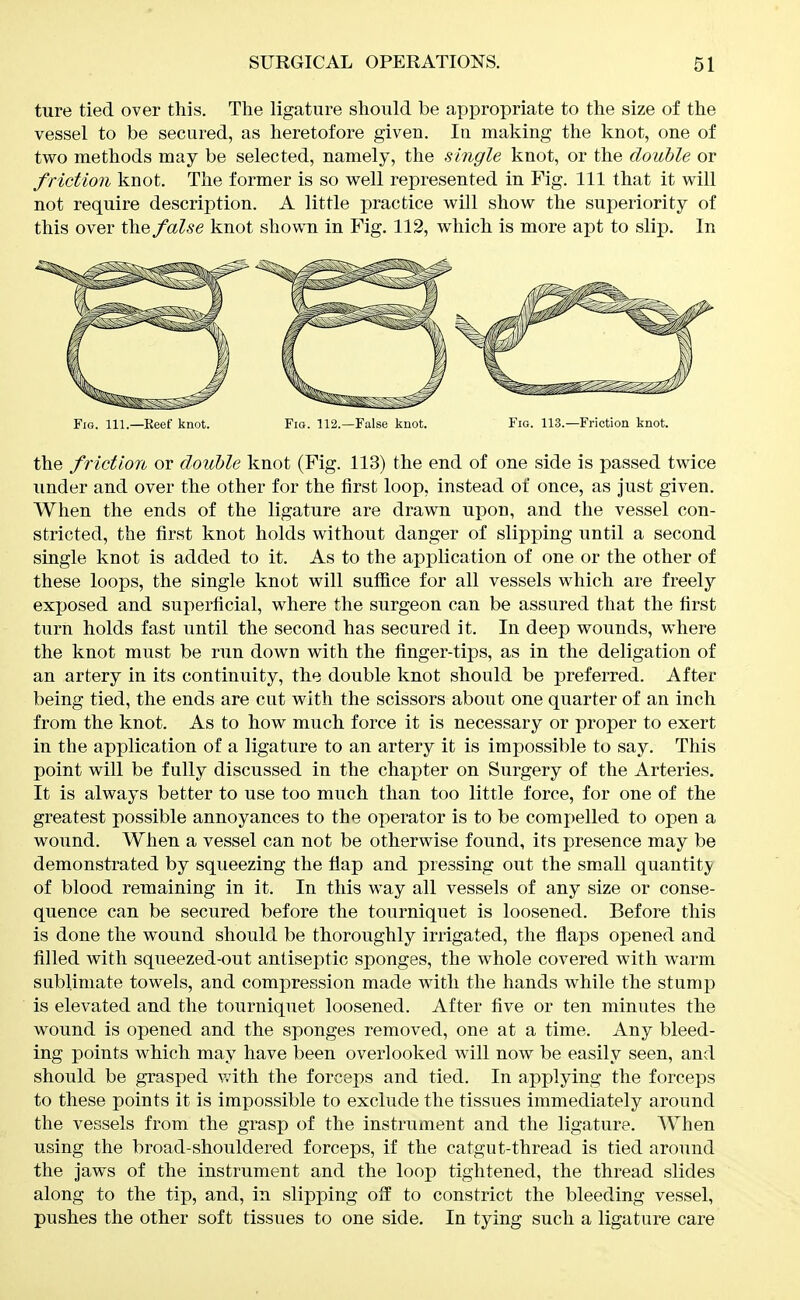 ture tied over this. The ligature should be appropriate to the size of the vessel to be secured, as heretofore given. In making the knot, one of two methods may be selected, namely, the single knot, or the double or friction knot. The former is so well represented in Fig. Ill that it will not require description. A little practice will show the superiority of this over the false knot shown in Fig. 112, which is more apt to slip. In Fig. 111.—Keef knot. Fia. 112.—False knot. Fig. 113.—Friction knot. the friction or double knot (Fig. 113) the end of one side is passed tvTice under and over the other for the first loop, instead of once, as just given. When the ends of the ligature are drawn upon, and the vessel con- stricted, the first knot holds without danger of slipping until a second single knot is added to it. As to the application of one or the other of these loops, the single knot will sufiice for all vessels which are freelj^ exjjosed and superficial, where the surgeon can be assured that the first turn holds fast until the second has secured it. In deep wounds, where the knot must be run down with the finger-tips, as in the deligation of an artery in its continuity, the double knot should be preferred. After being tied, the ends are cut with the scissors about one quarter of an inch from the knot. As to how much force it is necessary or proper to exert in the application of a ligature to an artery it is impossible to say. This point will be fully discussed in the chapter on Surgery of the Arteries. It is always better to use too much than too little force, for one of the greatest possible annoyances to the operator is to be compelled to open a wound. When a vessel can not be otherwise found, its presence may be demonstrated by squeezing the flap and pressing out the small quantity of blood remaining in it. In this way all vessels of any size or conse- quence can be secured before the tourniquet is loosened. Before this is done the wound should be thoroughly irrigated, the flaps opened and filled with squeezed-out antiseptic sponges, the whole covered with warm sublimate towels, and compression made with the hands while the stump is elevated and the tourniquet loosened. After five or ten minutes the wound is opened and the sponges removed, one at a time. Any bleed- ing points which may have been overlooked will now be easily seen, and should be grasped v/ith the forceps and tied. In applying the forceps to these points it is impossible to exclude the tissues immediately around the vessels from the grasp of the instrument and the ligature. When using the broad-shouldered forceps, if the catgut-thread is tied around the Jaws of the instrument and the loop tightened, the thread slides along to the tip, and, in slipping off to constrict the bleeding vessel, pushes the other soft tissues to one side. In tying such a ligature care