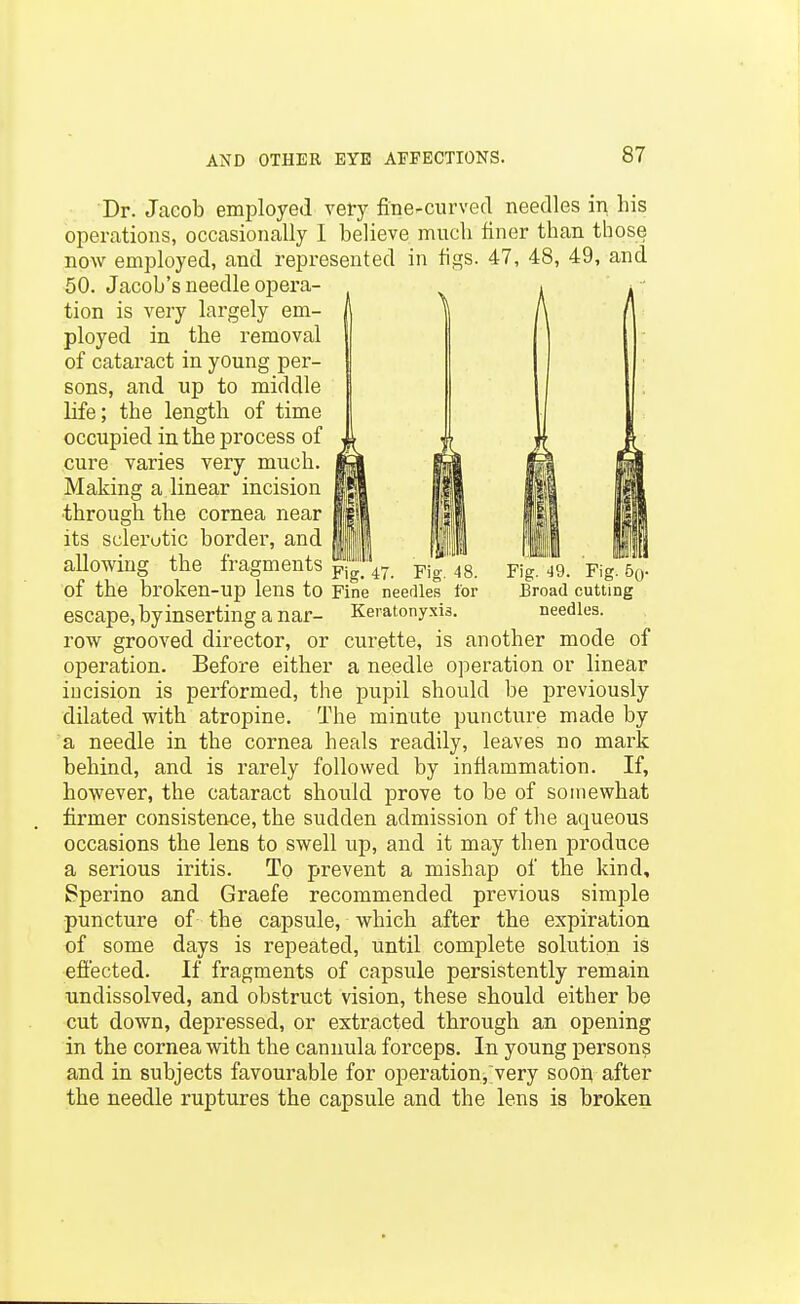 Fig. 49. Fig. So- Broad cutting needles. Dr. Jacob employed very fine-curved needles in his operations, occasionally 1 believe much finer than those now employed, and represented in figs. 47, 48, 49, and 50. Jacob's needle opera- tion is very largely em- ployed in the removal of cataract in young per- sons, and up to middle life; the length of time occupied in the process of cure varies very much. Making a linear incision through the cornea near its sclerotic border, and allowing the fragments p|g%7. yig 43. of the broken-up lens to Fine needles for escape, by inserting a nar- Keratonyxis. row grooved director, or curette, is another mode of operation. Before either a needle operation or linear incision is performed, the pupil should be previously dilated with atropine. The minute puncture made by a needle in the cornea heals readily, leaves no mark behind, and is rarely followed by inflammation. If, however, the cataract should prove to be of somewhat firmer consistence, the sudden admission of the aqueous occasions the lens to swell up, and it may then produce a serious iritis. To prevent a mishap of the kind, Sperino and Graefe recommended previous simple puncture of the capsule, which after the expiration of some days is repeated, until complete solution is efiected. If fragments of capsule persistently remain undissolved, and obstruct vision, these should either be cut down, depressed, or extracted through an opening in the cornea with the cannula forceps. In young persons and in subjects favourable for operation,;very soon after the needle ruptures the capsule and the lens is broken